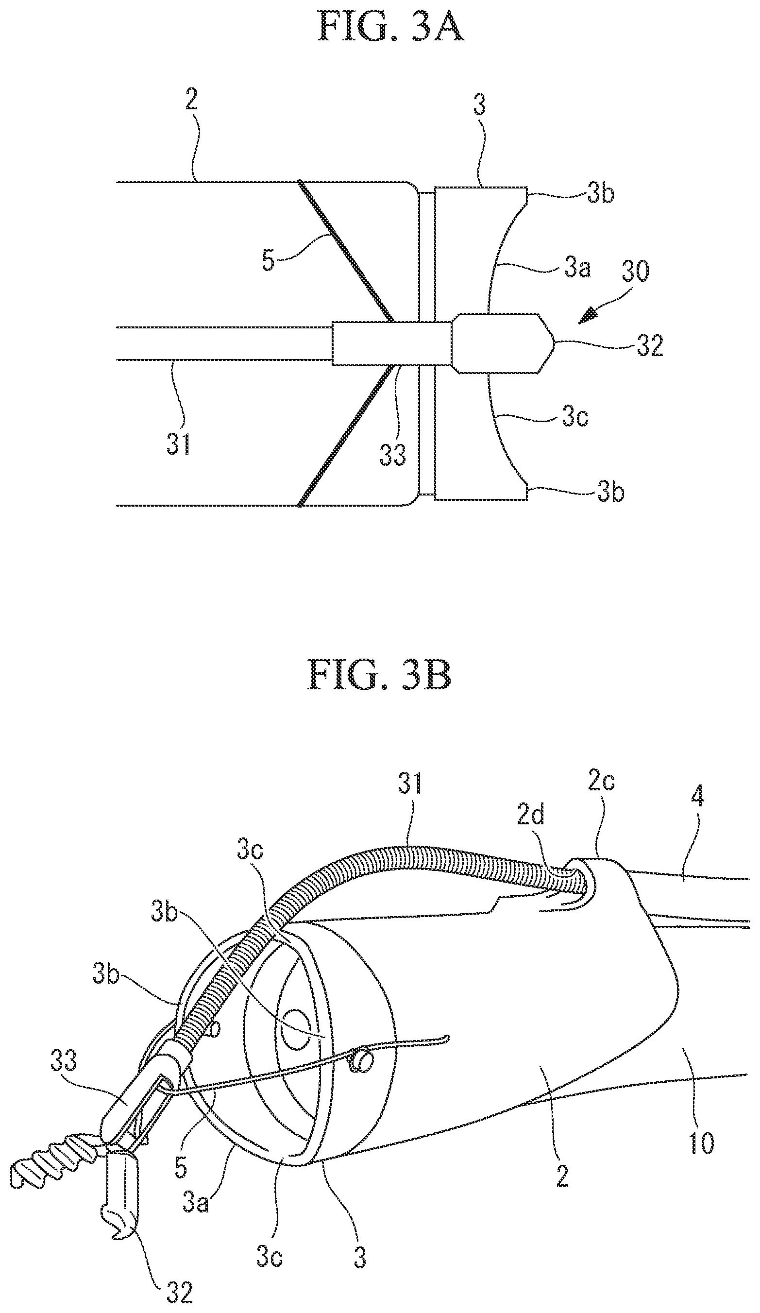 Patent US12551091 Figure 5 – Endoscope cap, endoscope treatment tool, and endoscope system