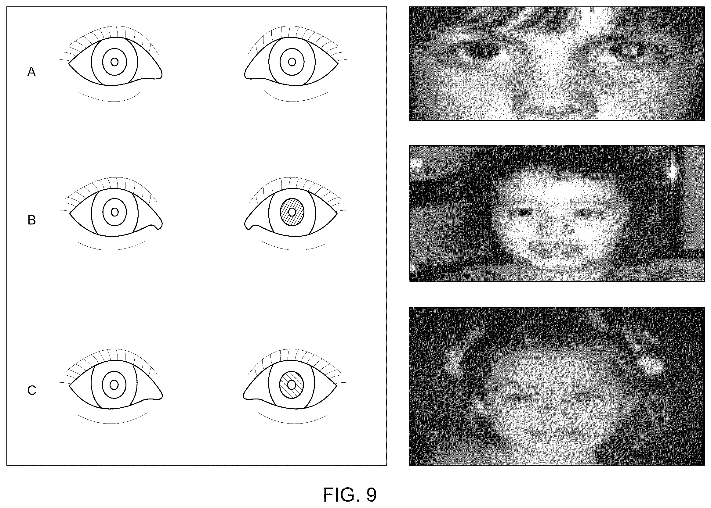 Patent US12551097 Figure 9 – Systems and methods for evaluating pupillary responses