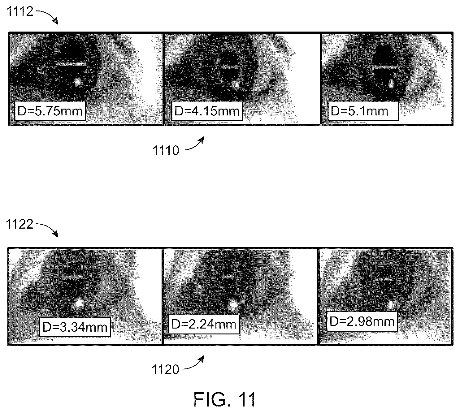 Patent US12551097 Figure 11 – Systems and methods for evaluating pupillary responses