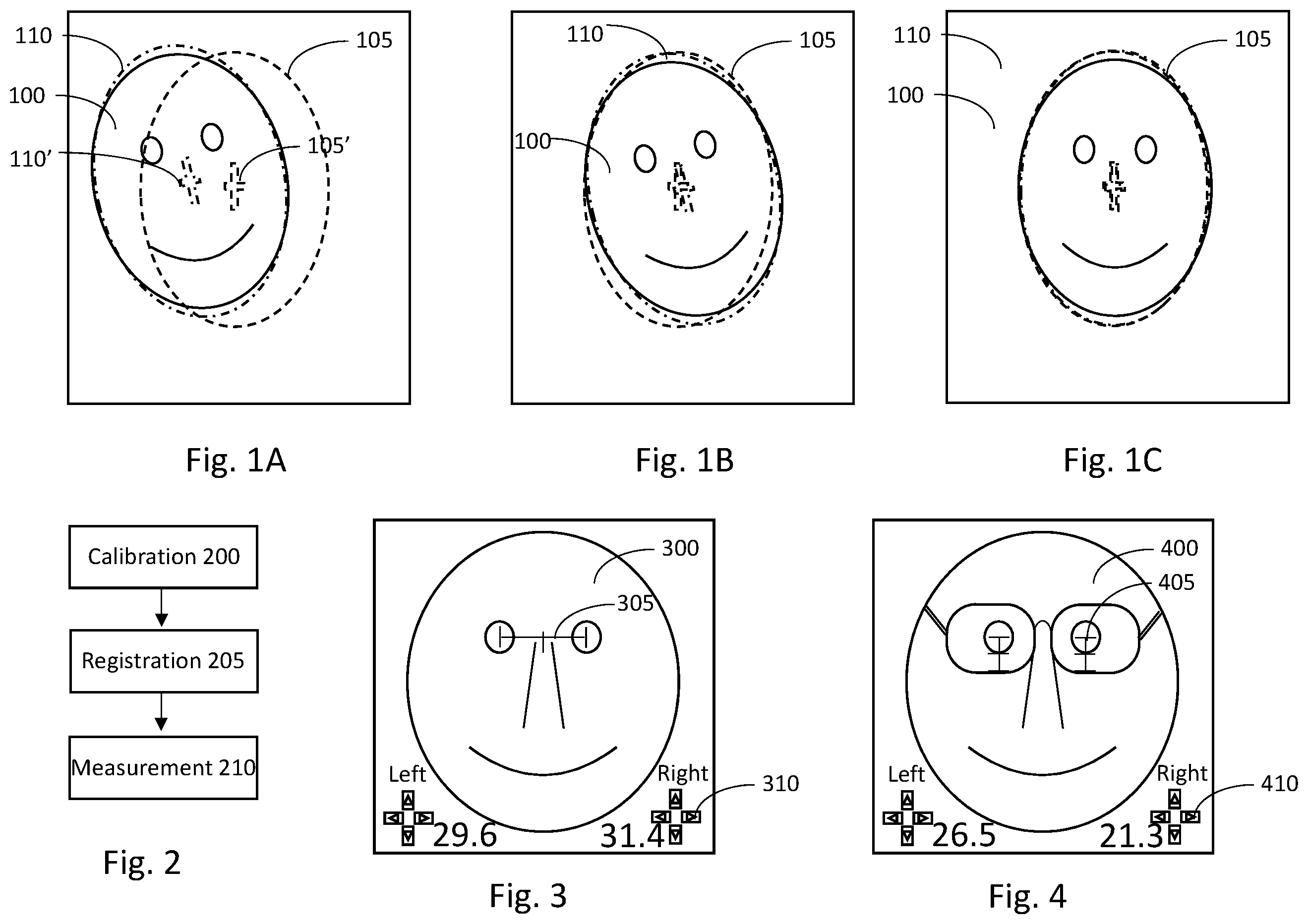 Patent US12551101 Figure 1 – System and method for digital measurements of subjects
