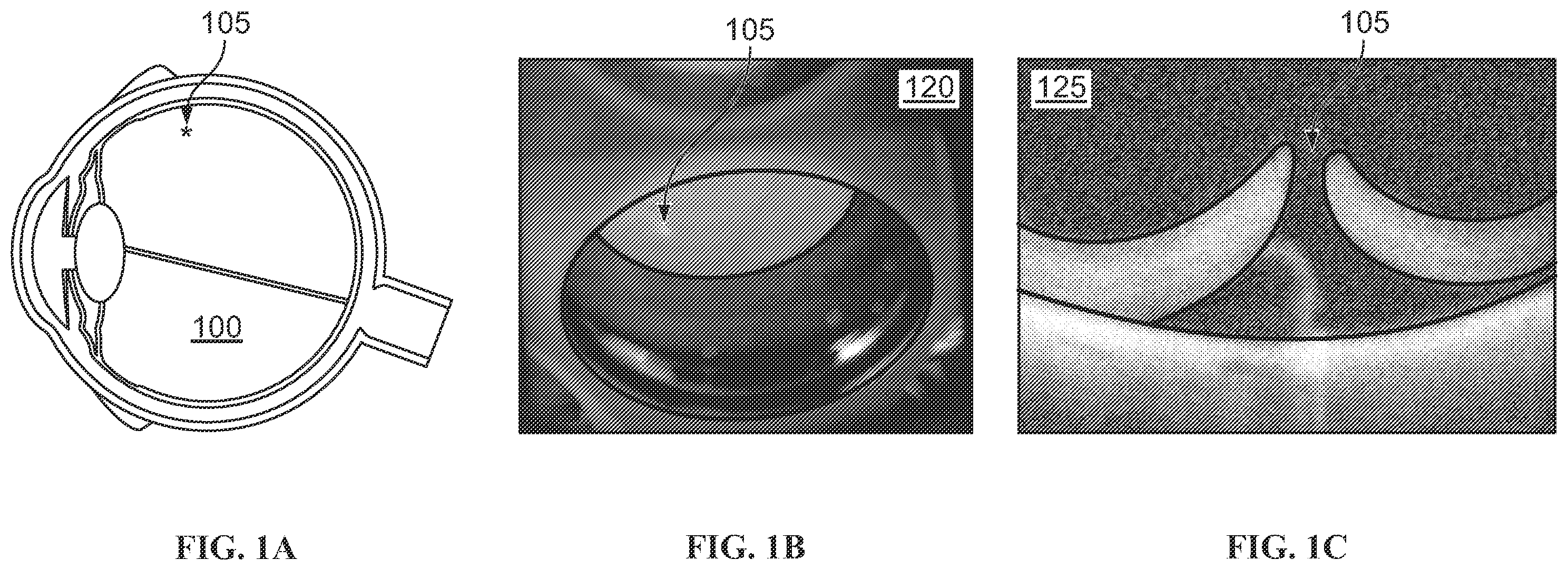 Patent US12551102 Figure 1 – Systems and methods for peripheral retinal optical coherence tomography