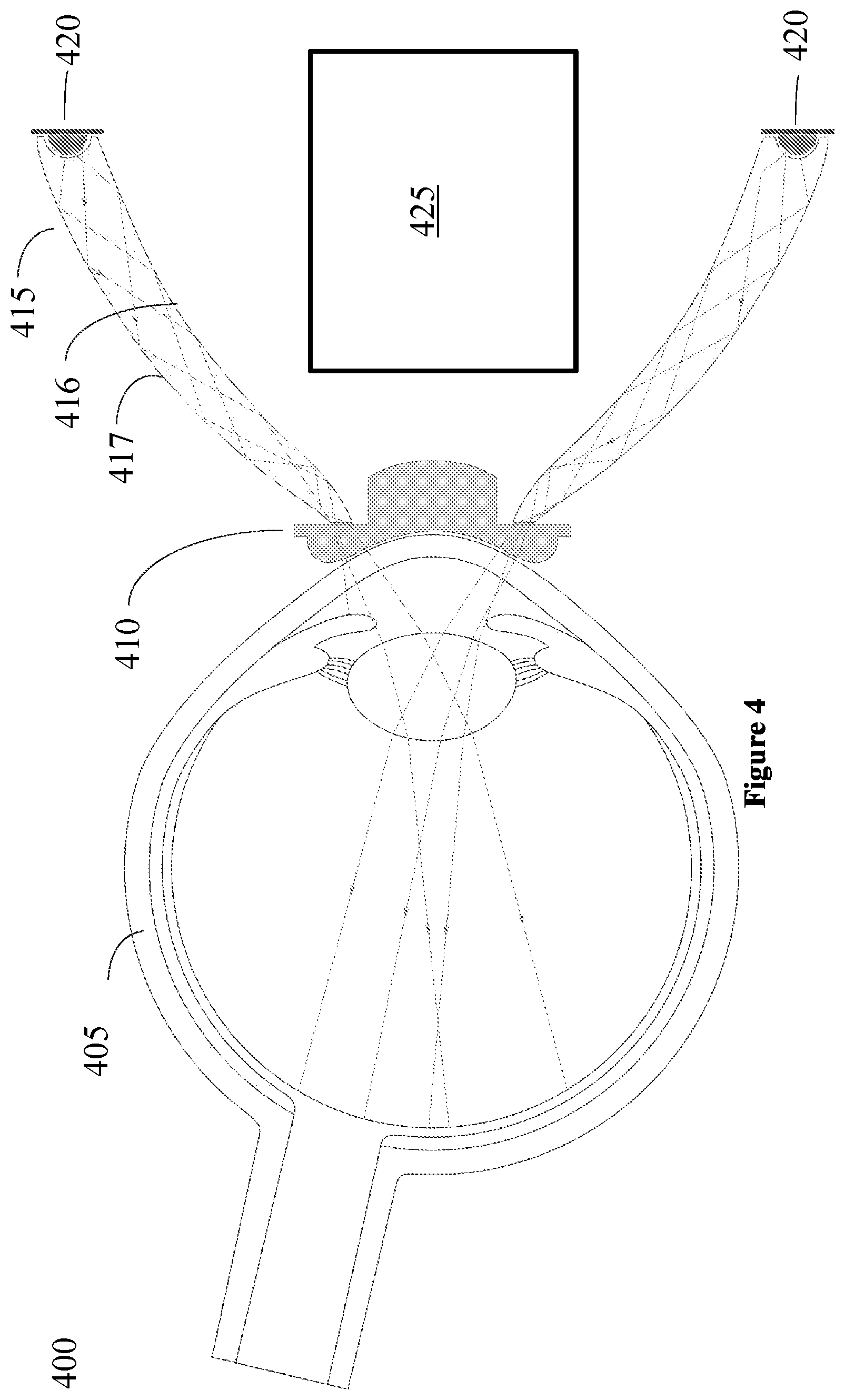 Patent US12551103 Figure 4 – Annular light source device for neonatal fundus camera