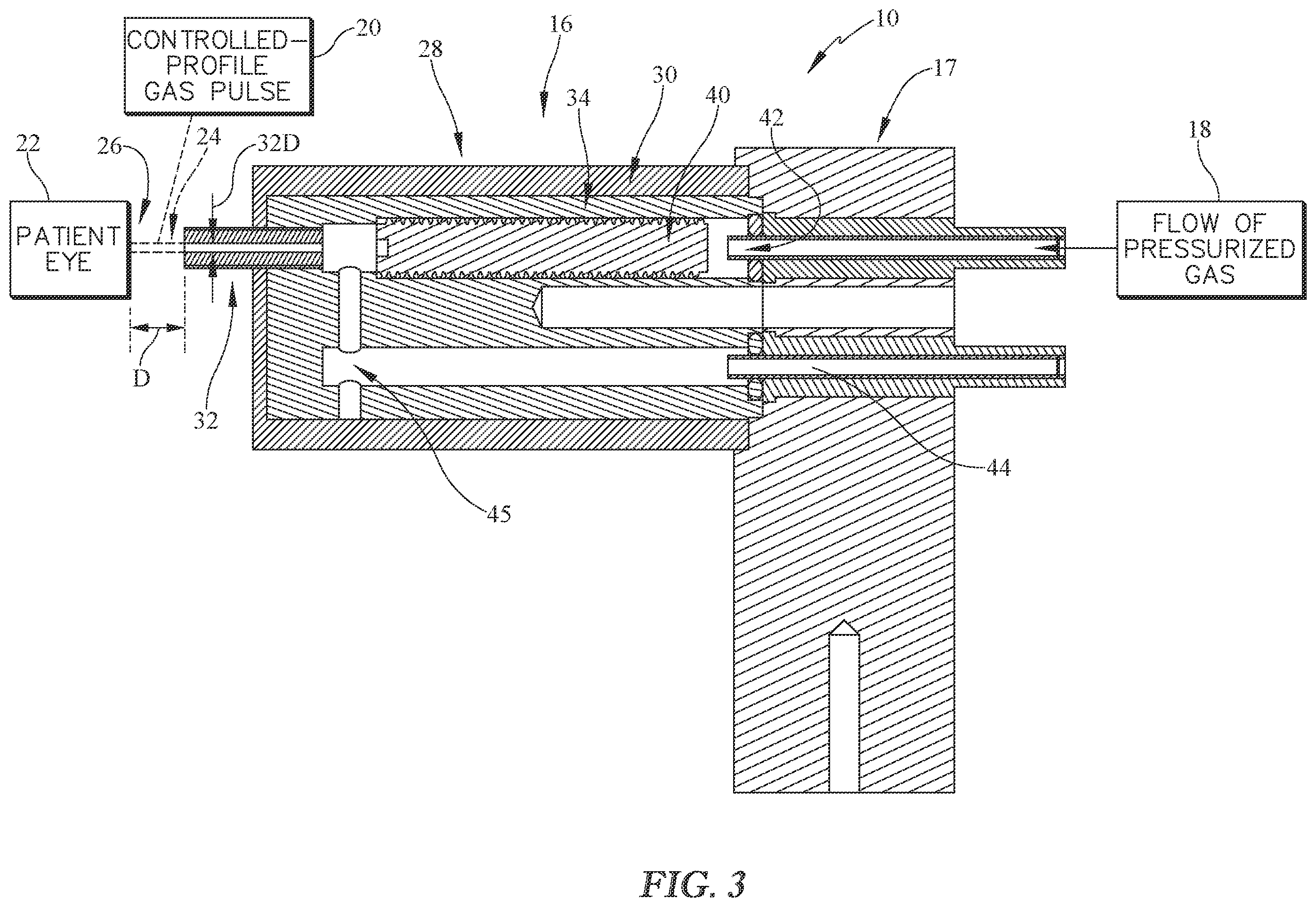 Patent US12551104 Figure 2 – Pneumatic esthesiometer with gas pulse-conditioner