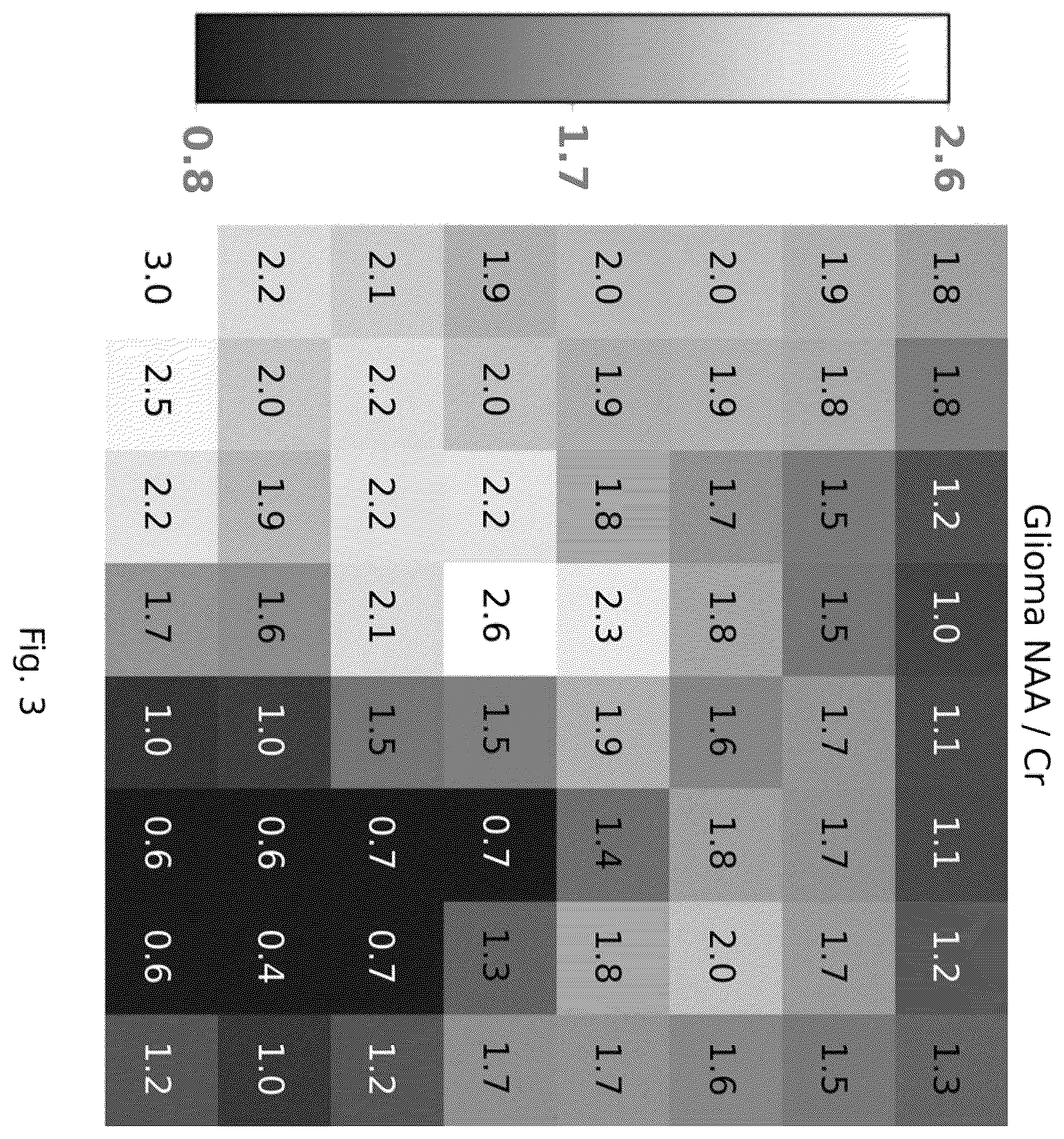 Patent US12551107 Figure 3 – Systems and methods of analyzing and interfacing with combined imaging and spectroscopy data for the brain