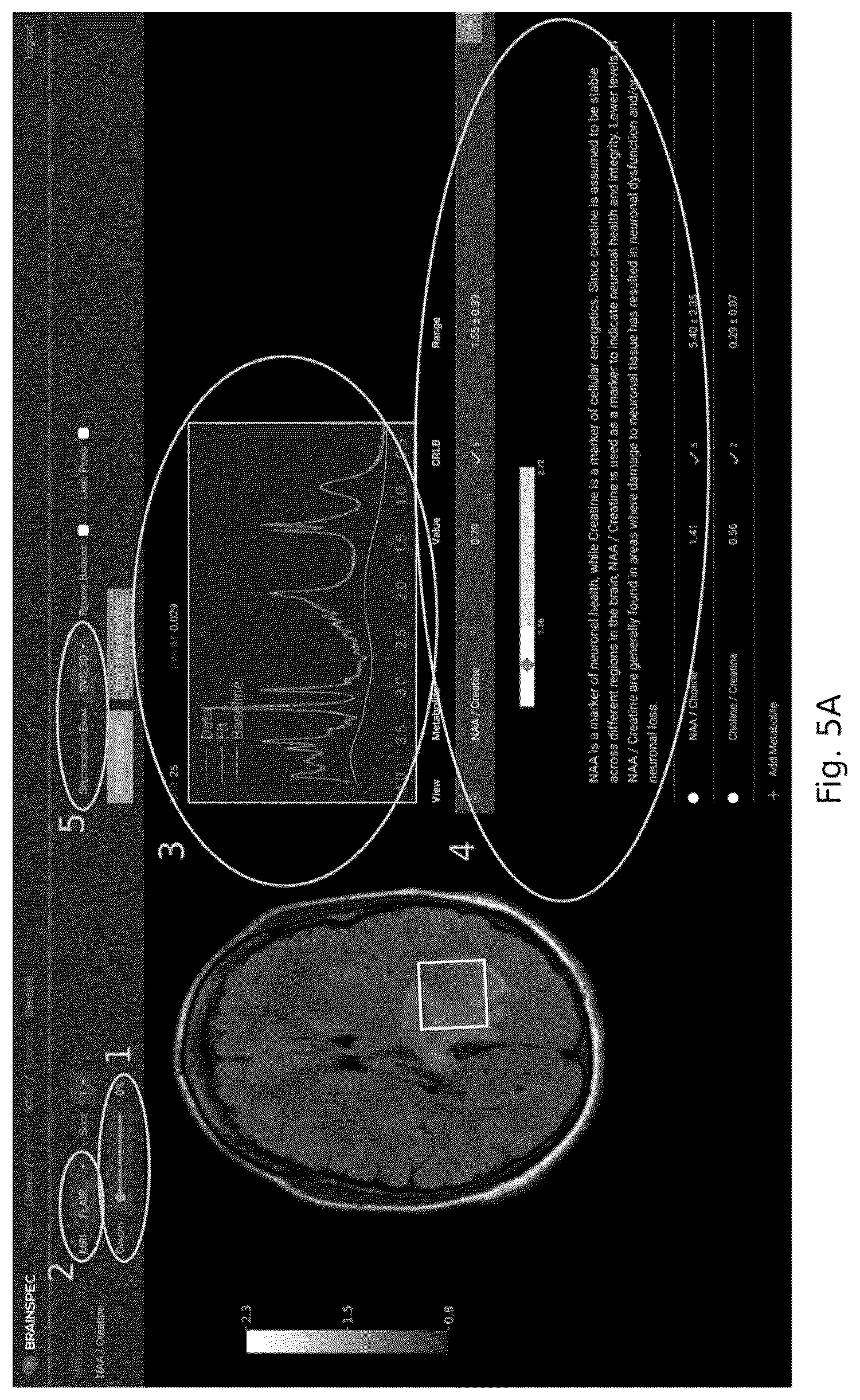 Patent US12551107 Figure 5 – Systems and methods of analyzing and interfacing with combined imaging and spectroscopy data for the brain