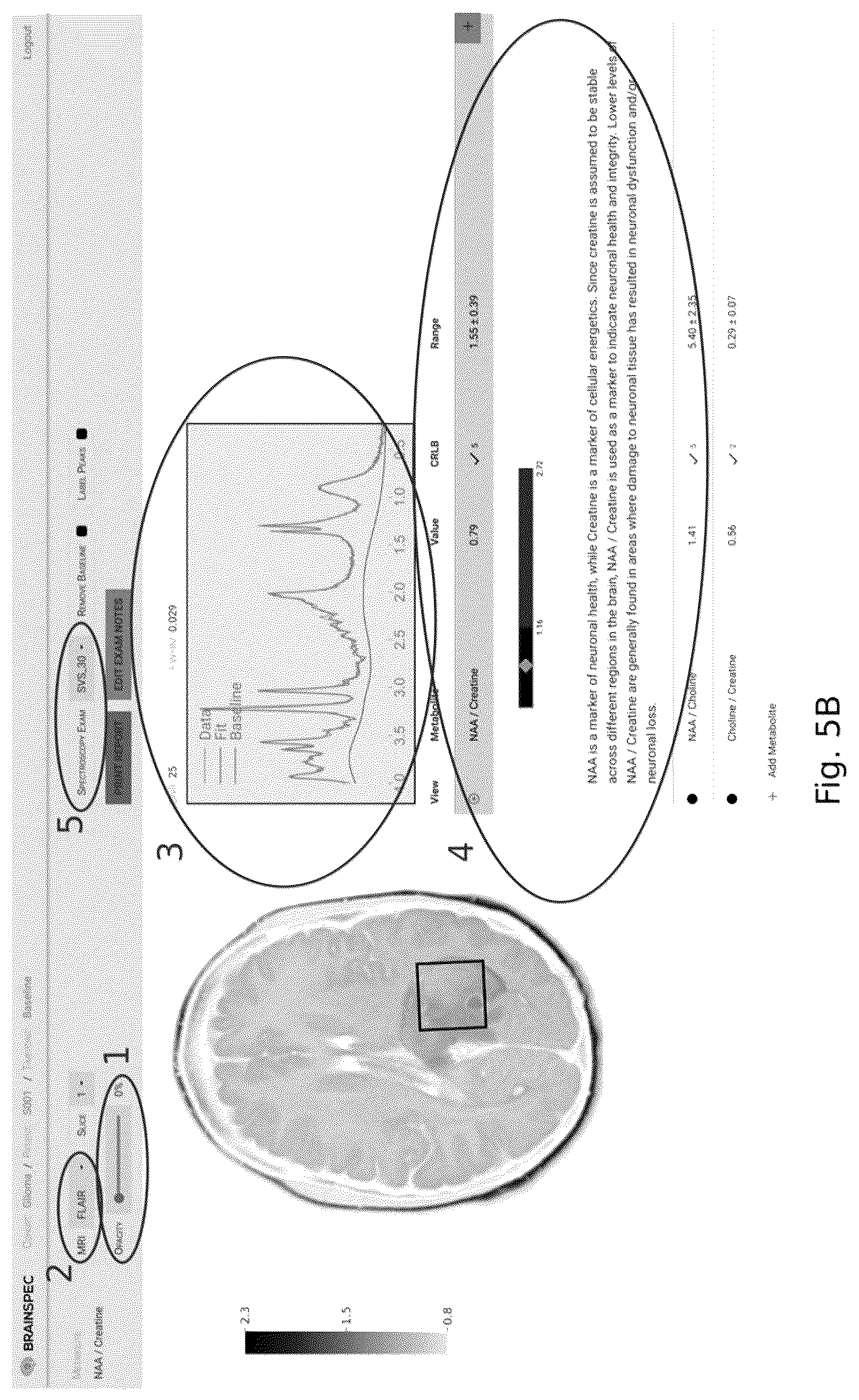 Patent US12551107 Figure 6 – Systems and methods of analyzing and interfacing with combined imaging and spectroscopy data for the brain