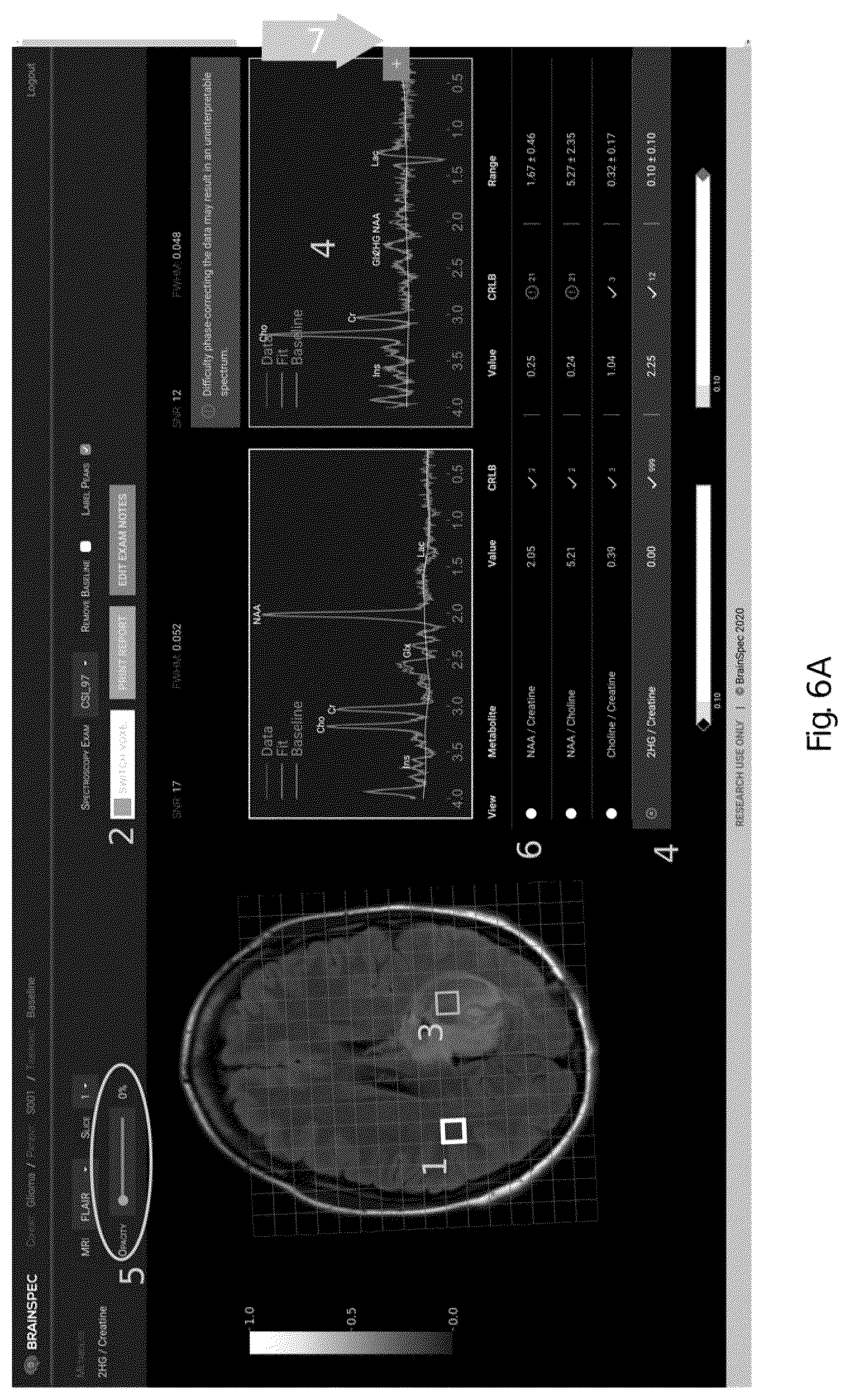 Patent US12551107 Figure 7 – Systems and methods of analyzing and interfacing with combined imaging and spectroscopy data for the brain