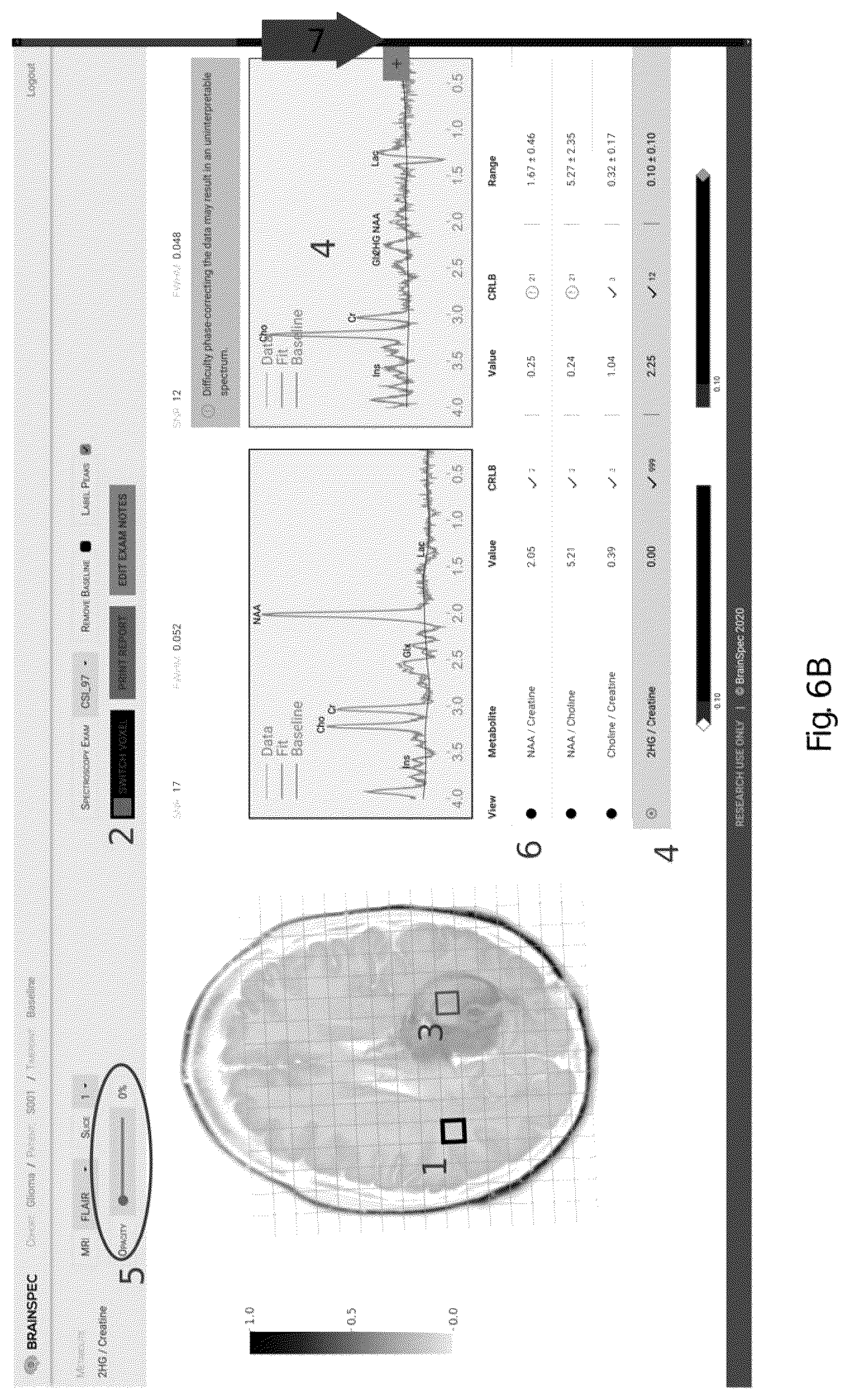 Patent US12551107 Figure 8 – Systems and methods of analyzing and interfacing with combined imaging and spectroscopy data for the brain