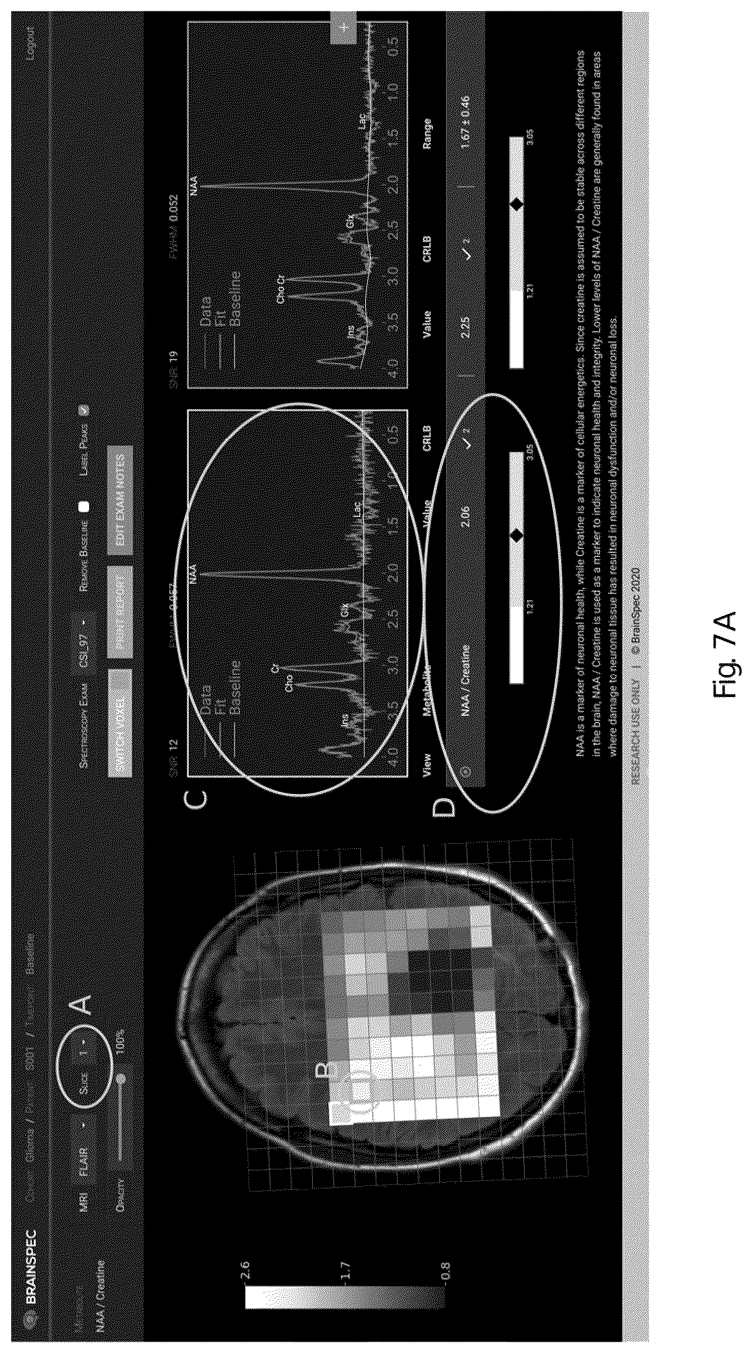 Patent US12551107 Figure 9 – Systems and methods of analyzing and interfacing with combined imaging and spectroscopy data for the brain
