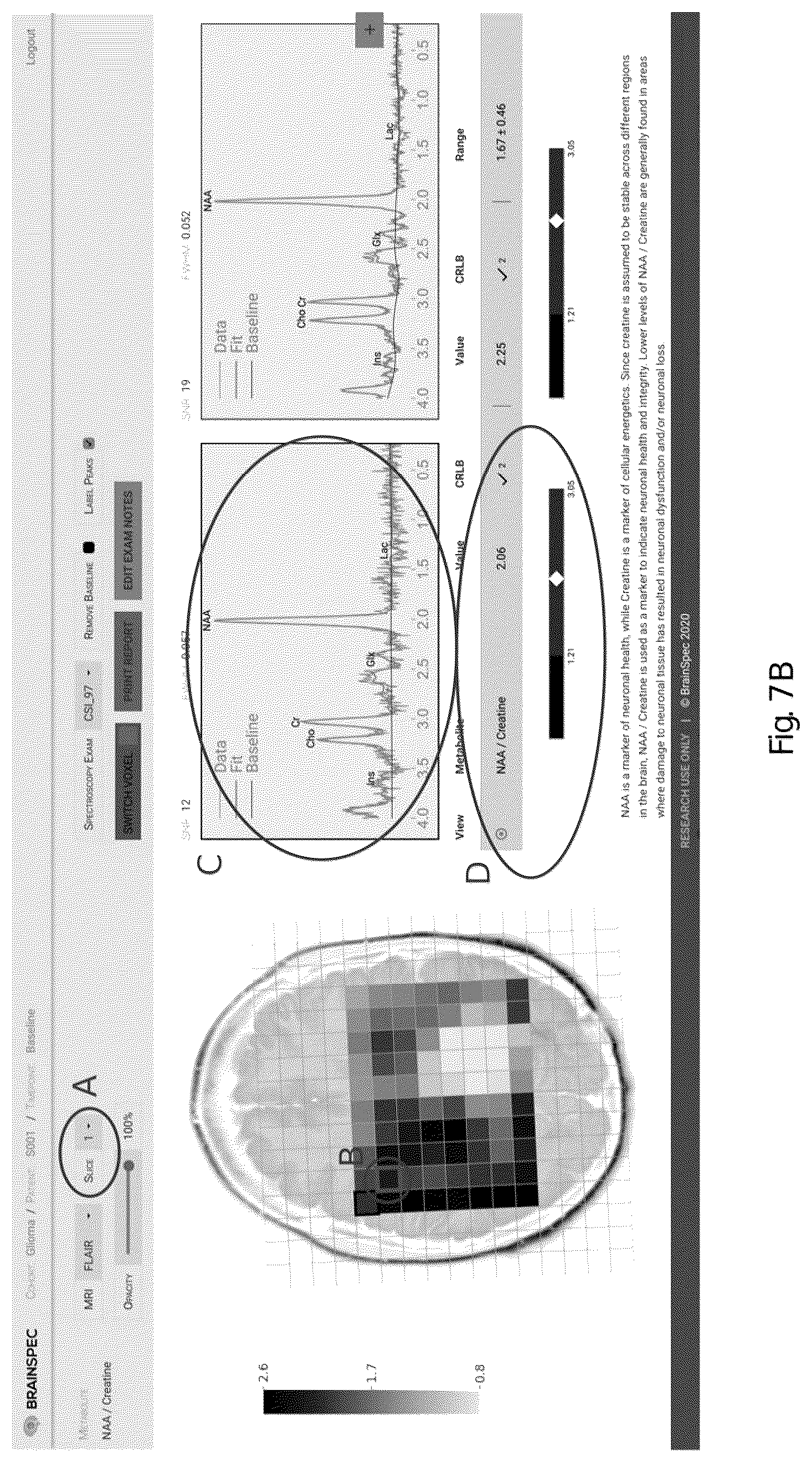 Patent US12551107 Figure 10 – Systems and methods of analyzing and interfacing with combined imaging and spectroscopy data for the brain