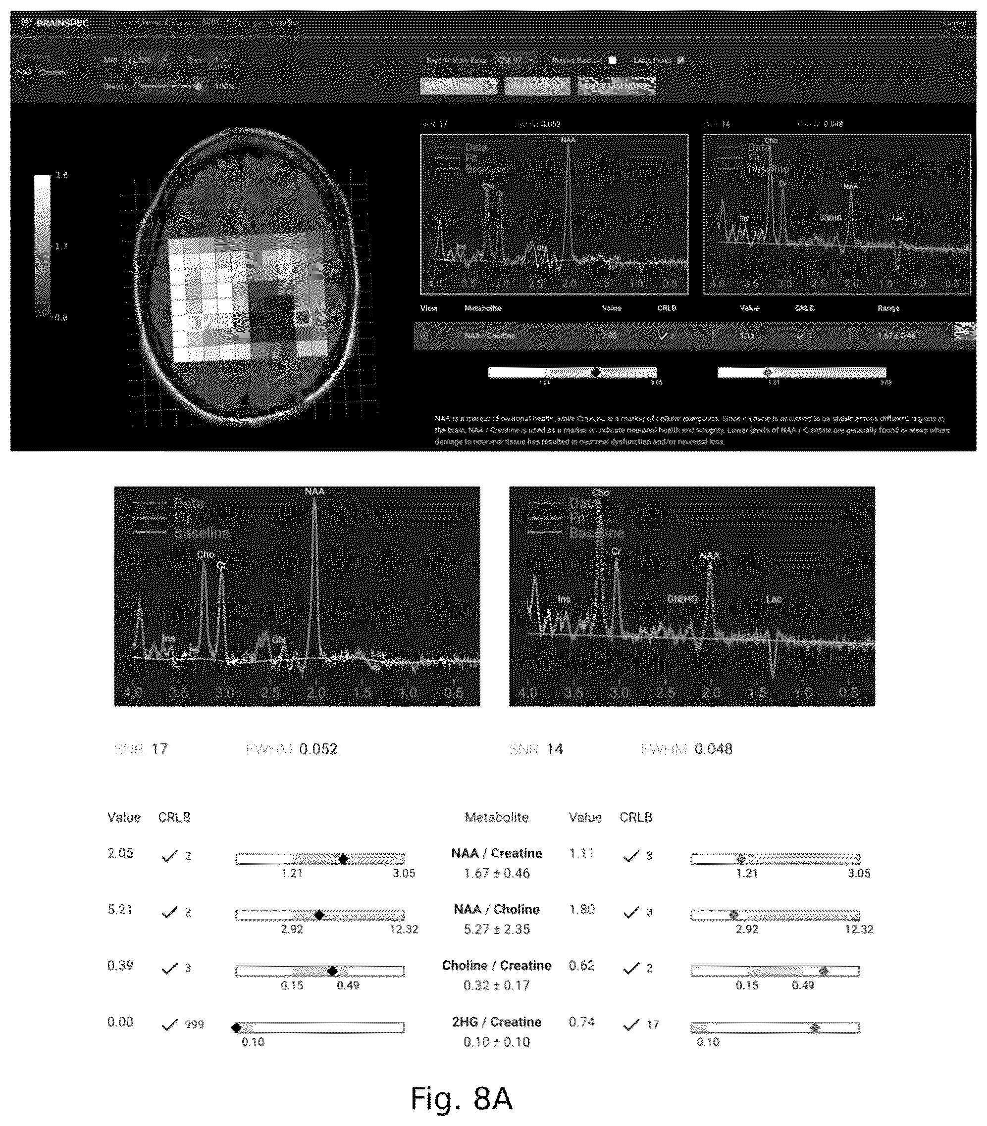 Patent US12551107 Figure 11 – Systems and methods of analyzing and interfacing with combined imaging and spectroscopy data for the brain