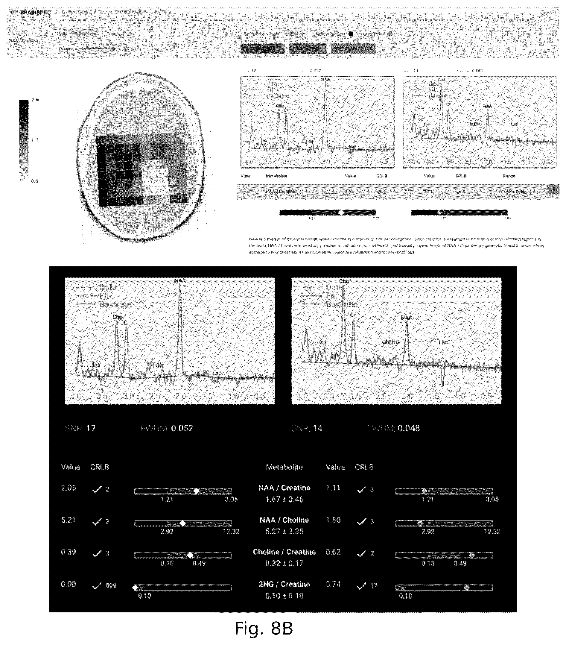 Patent US12551107 Figure 12 – Systems and methods of analyzing and interfacing with combined imaging and spectroscopy data for the brain