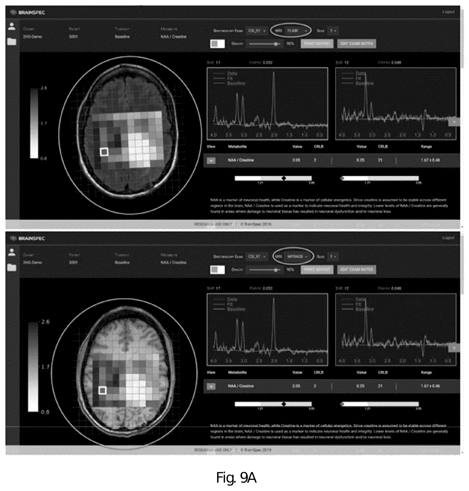 Patent US12551107 Figure 13 – Systems and methods of analyzing and interfacing with combined imaging and spectroscopy data for the brain