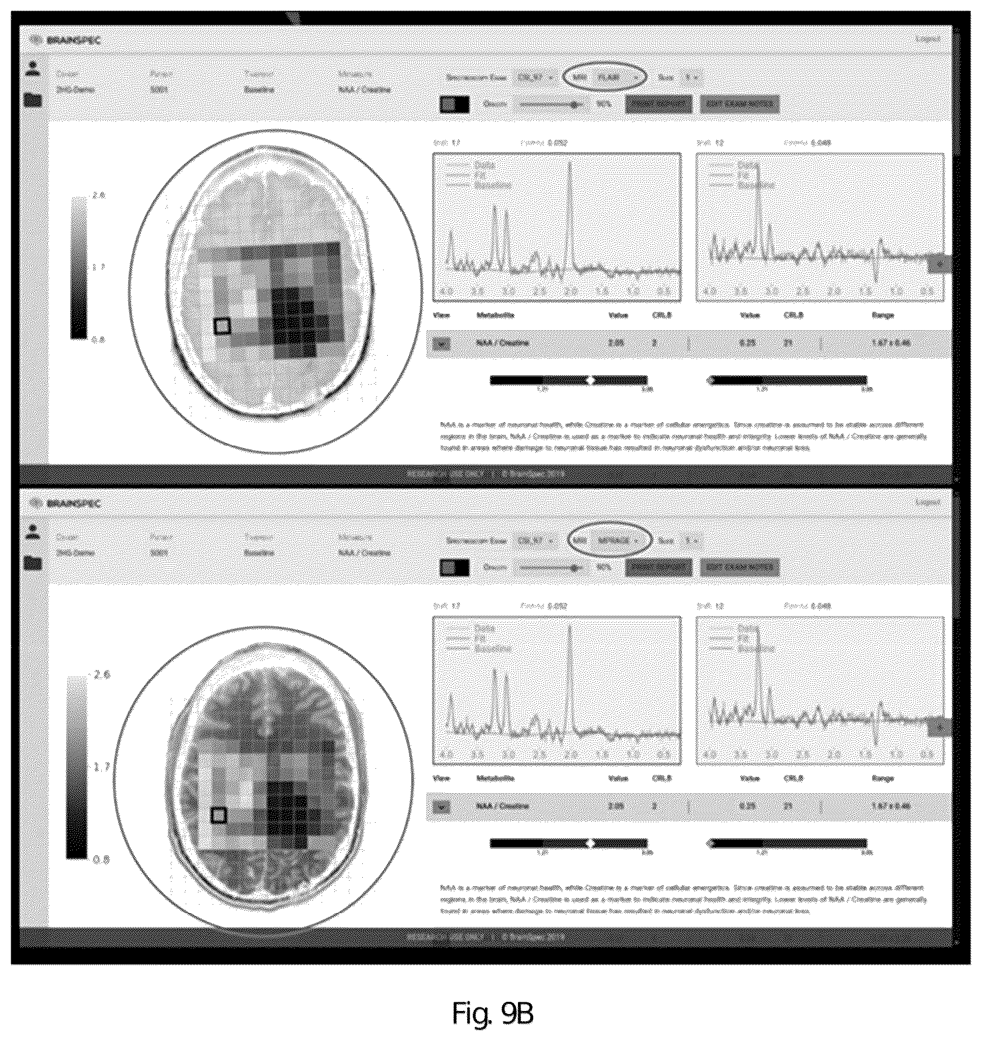 Patent US12551107 Figure 14 – Systems and methods of analyzing and interfacing with combined imaging and spectroscopy data for the brain