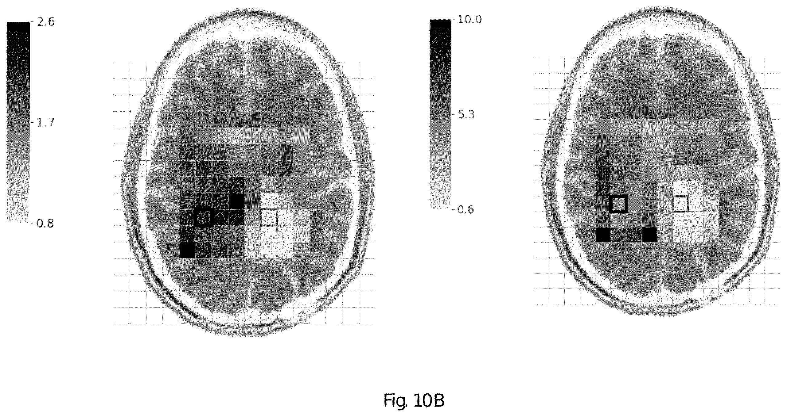 Patent US12551107 Figure 16 – Systems and methods of analyzing and interfacing with combined imaging and spectroscopy data for the brain