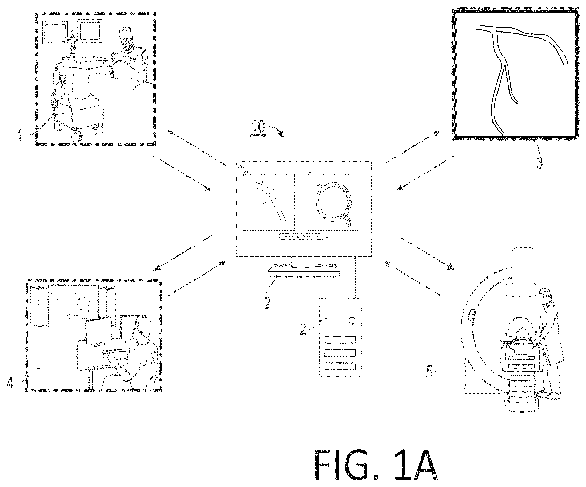 Patent US12551108 Figure 1 – Angiography image/video synchronization with pullback and angio delay measurement