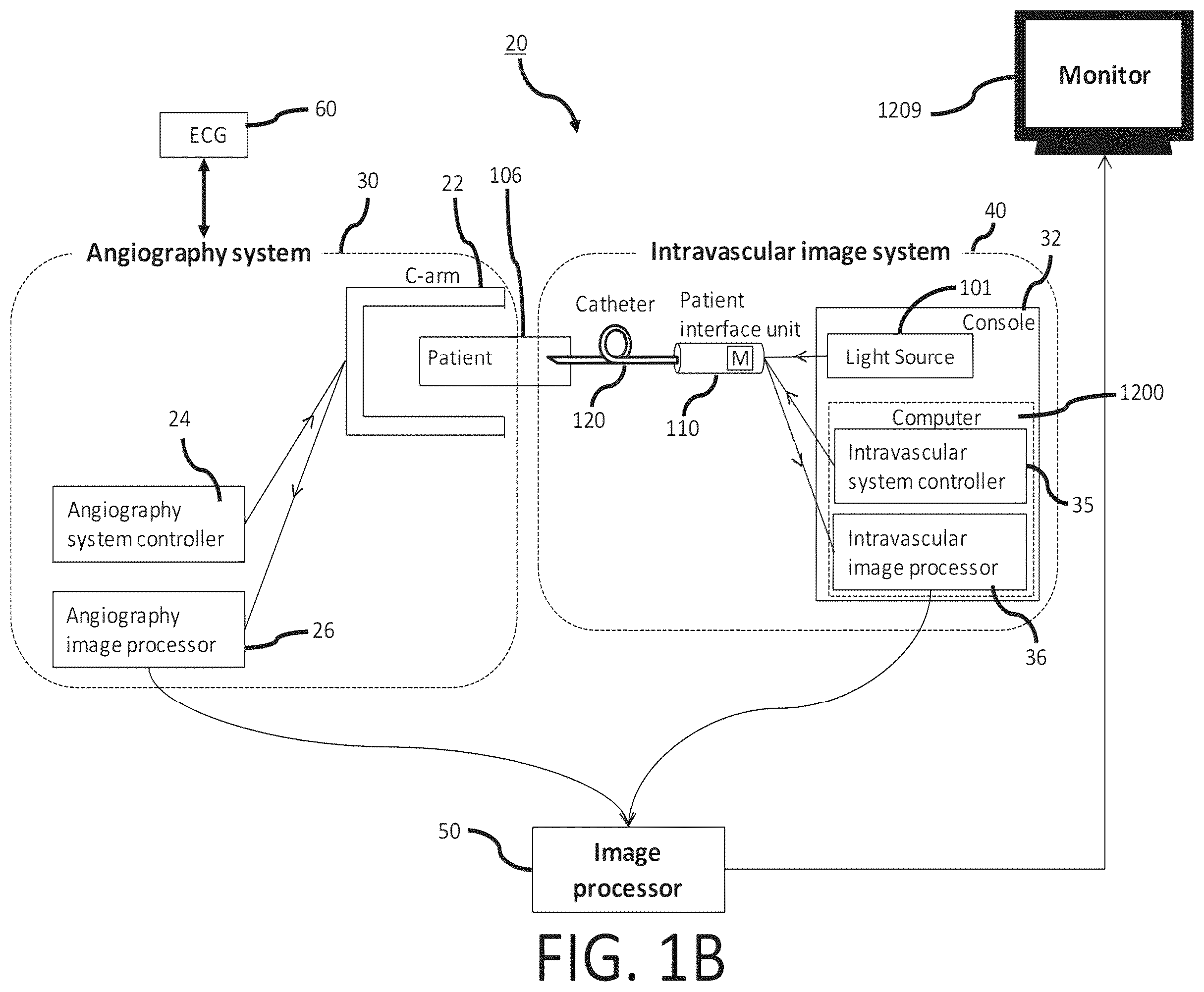 Patent US12551108 Figure 2 – Angiography image/video synchronization with pullback and angio delay measurement