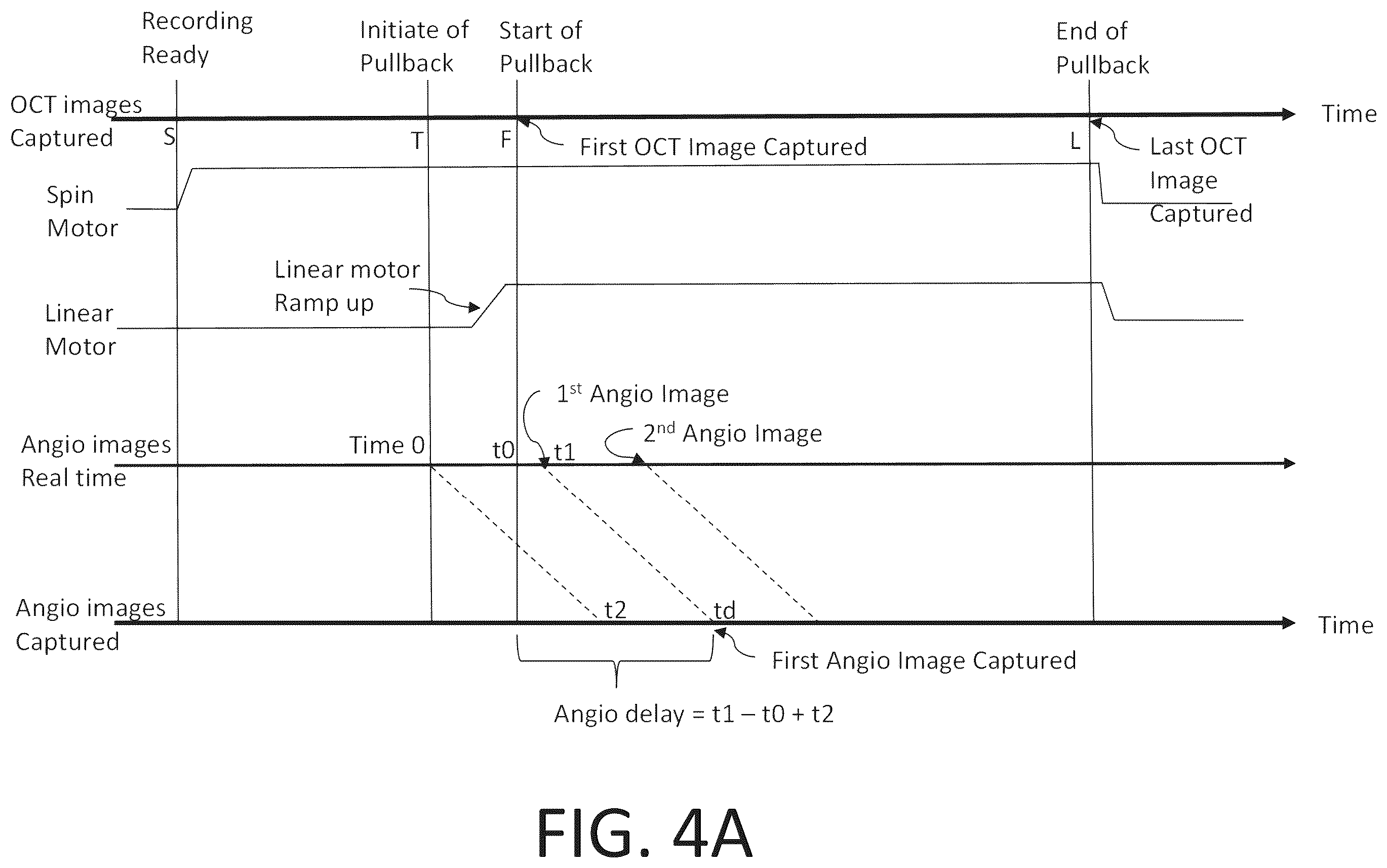 Patent US12551108 Figure 5 – Angiography image/video synchronization with pullback and angio delay measurement
