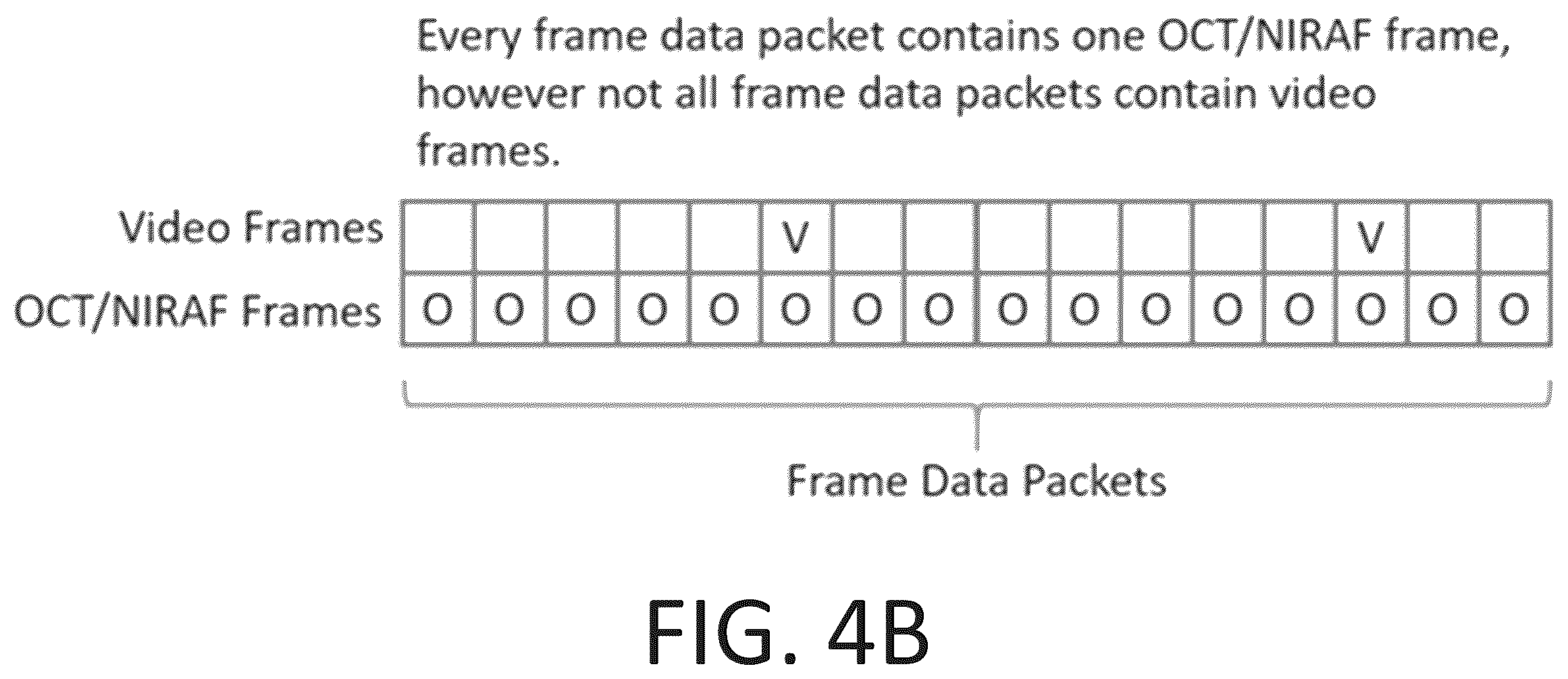 Patent US12551108 Figure 6 – Angiography image/video synchronization with pullback and angio delay measurement