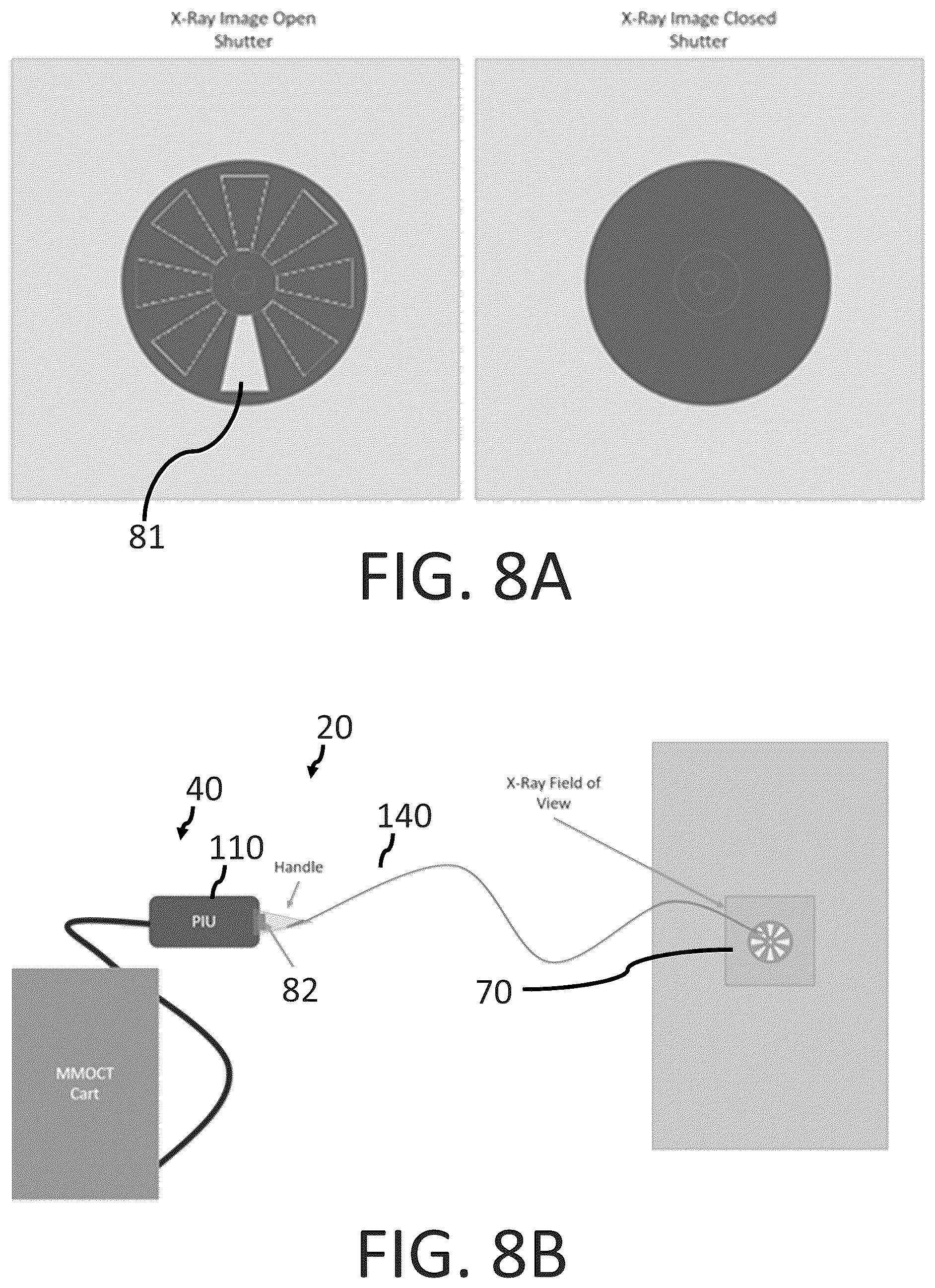 Patent US12551108 Figure 10 – Angiography image/video synchronization with pullback and angio delay measurement