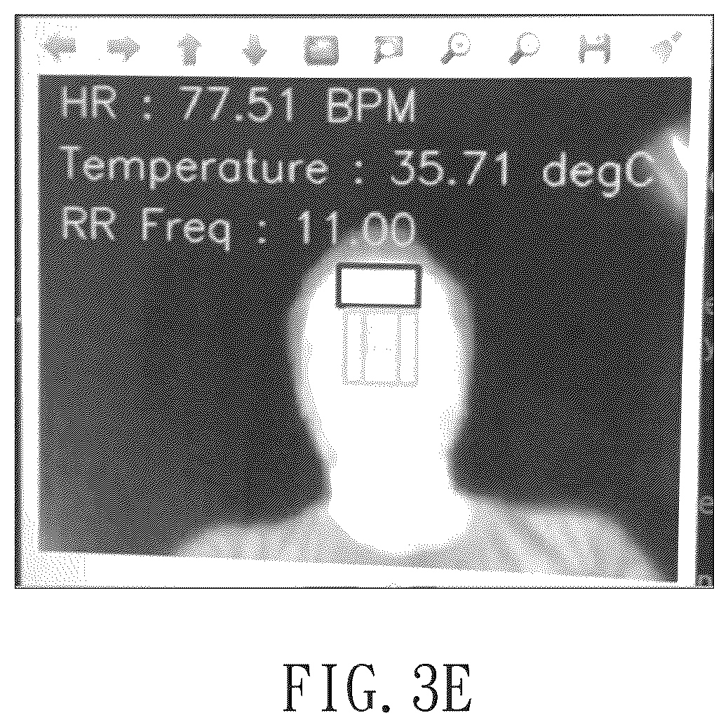 Patent US12551111 Figure 5 – Method and system for dynamic physiological characteristic region capturing