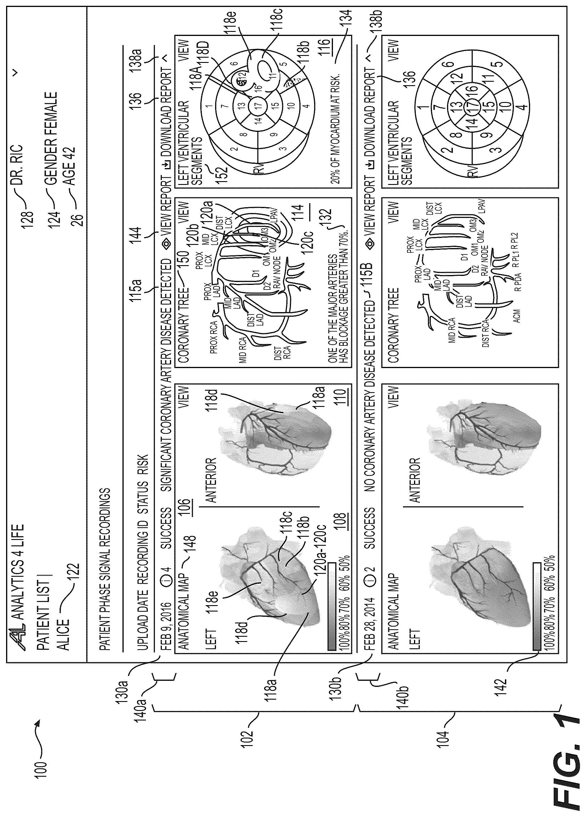 Patent US12551112 Figure 1 – Method and system for visualization of heart tissue at risk