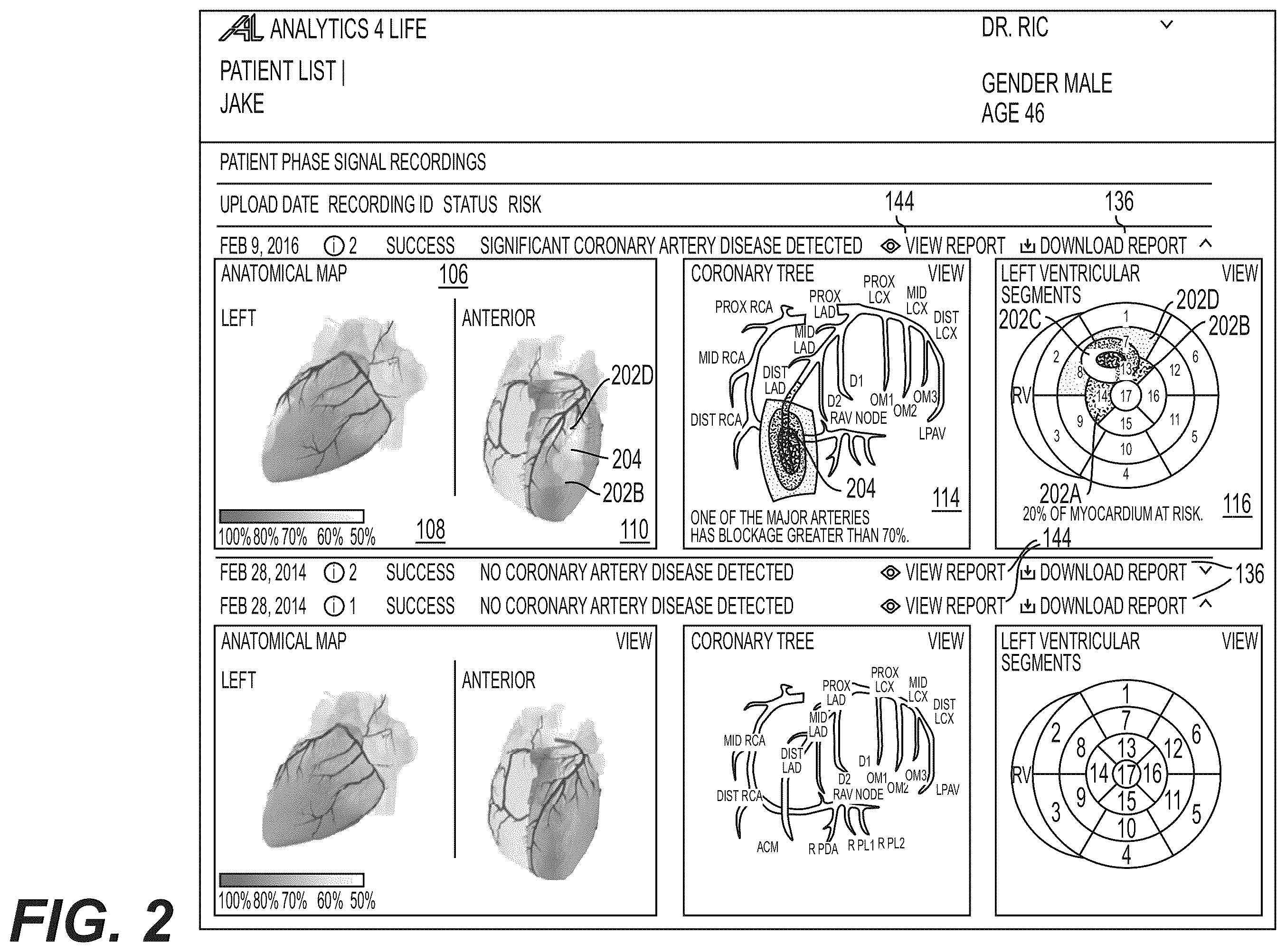 Patent US12551112 Figure 2 – Method and system for visualization of heart tissue at risk