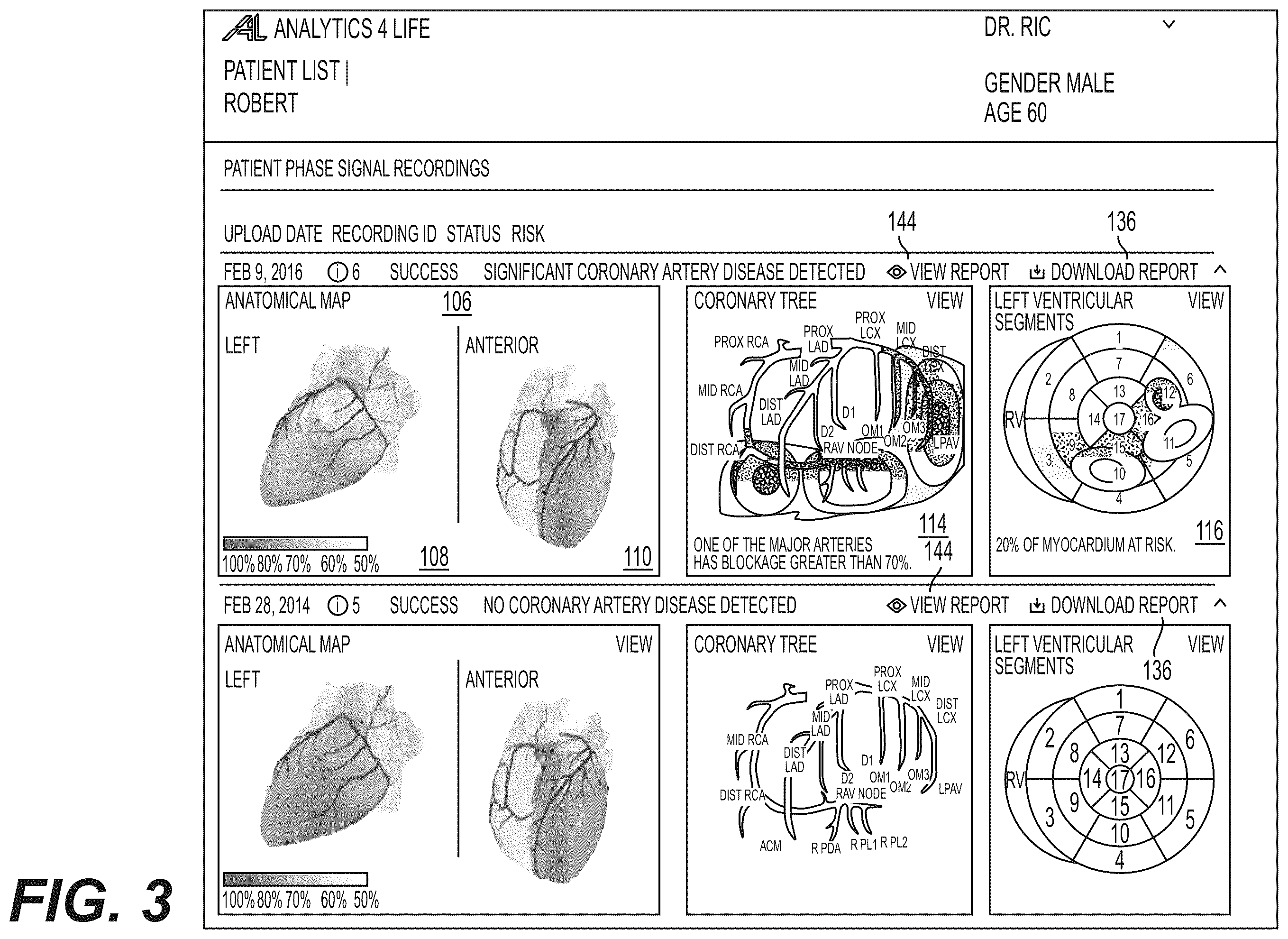 Patent US12551112 Figure 3 – Method and system for visualization of heart tissue at risk