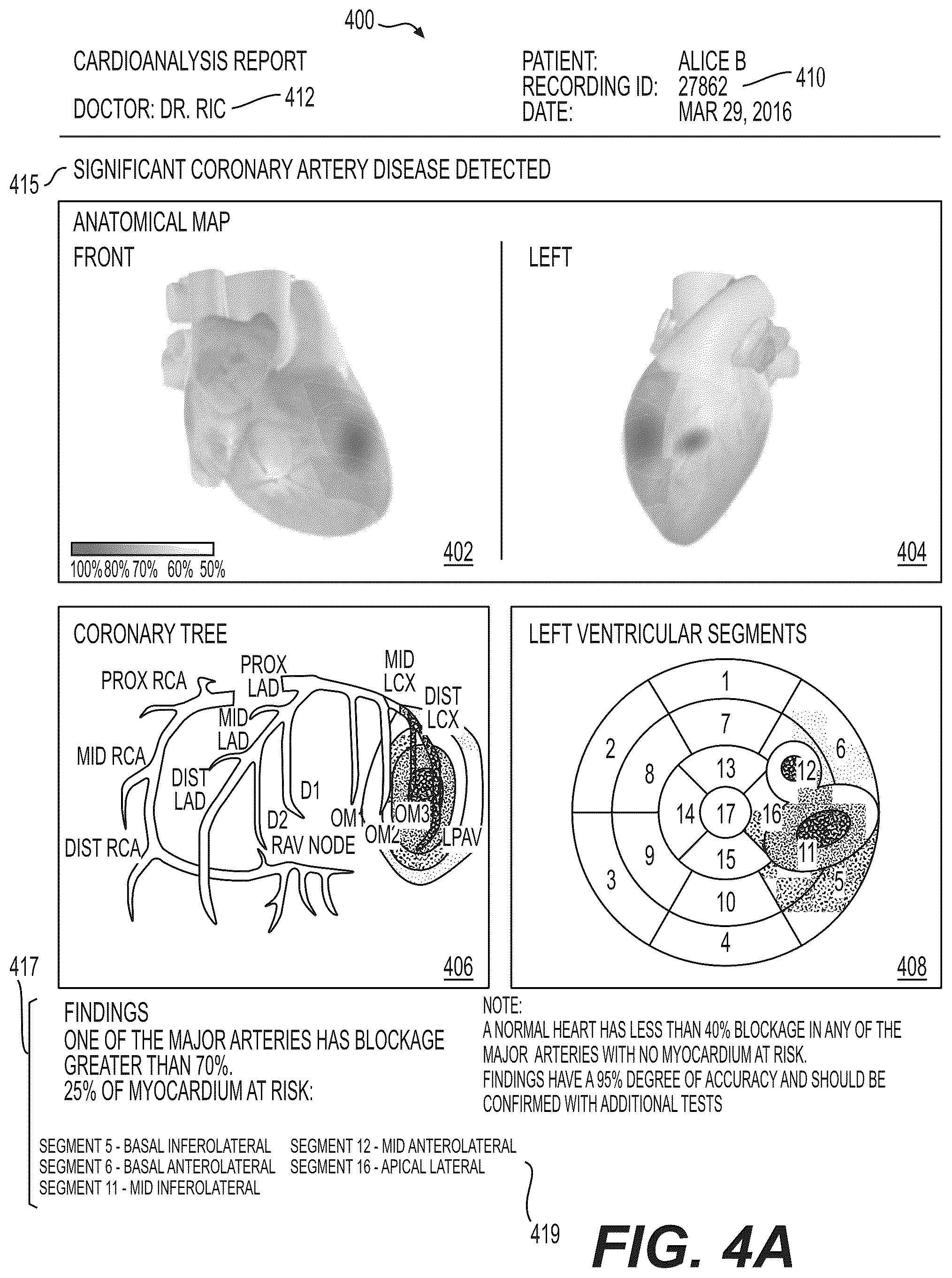 Patent US12551112 Figure 4 – Method and system for visualization of heart tissue at risk