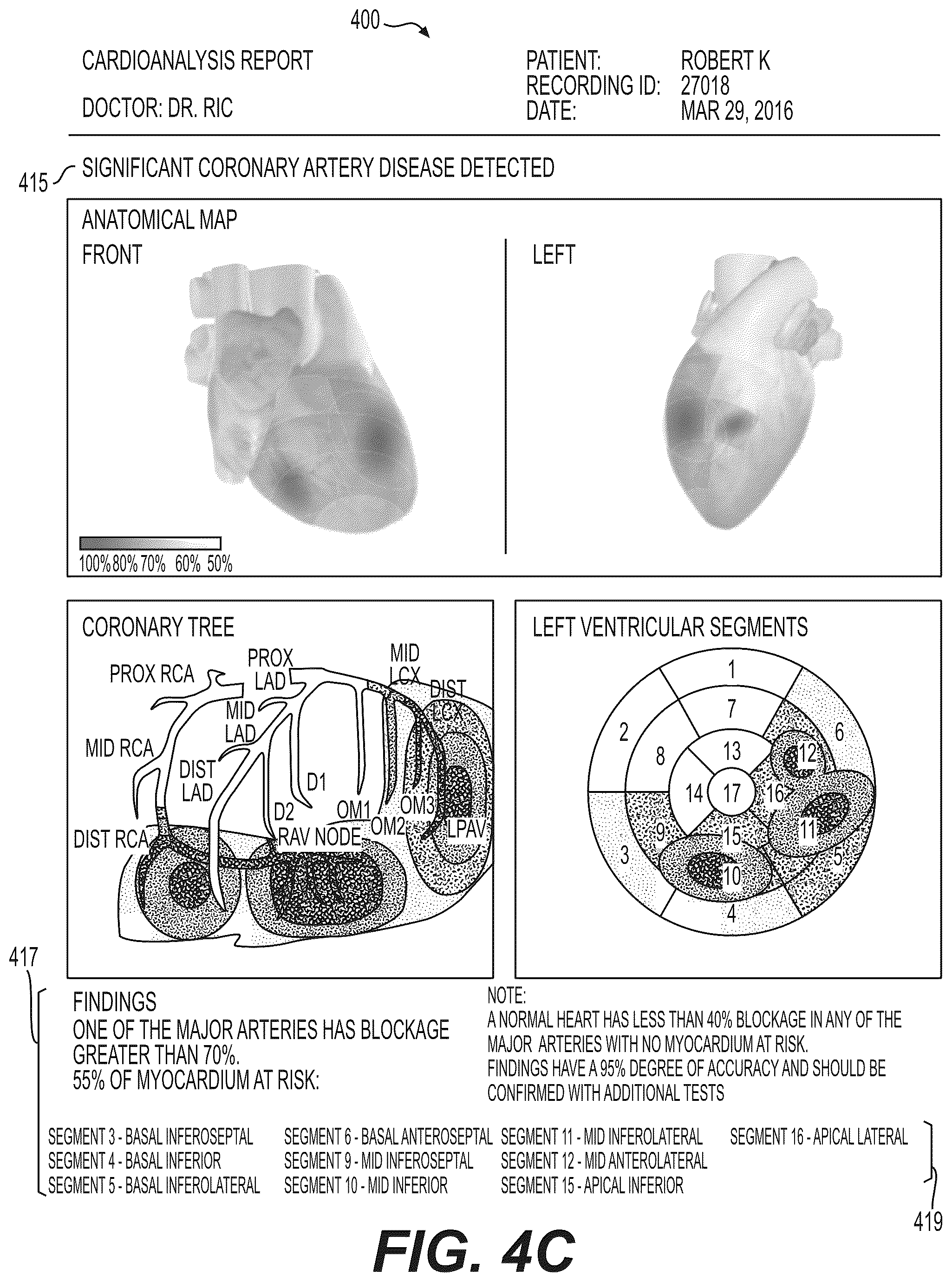 Patent US12551112 Figure 6 – Method and system for visualization of heart tissue at risk