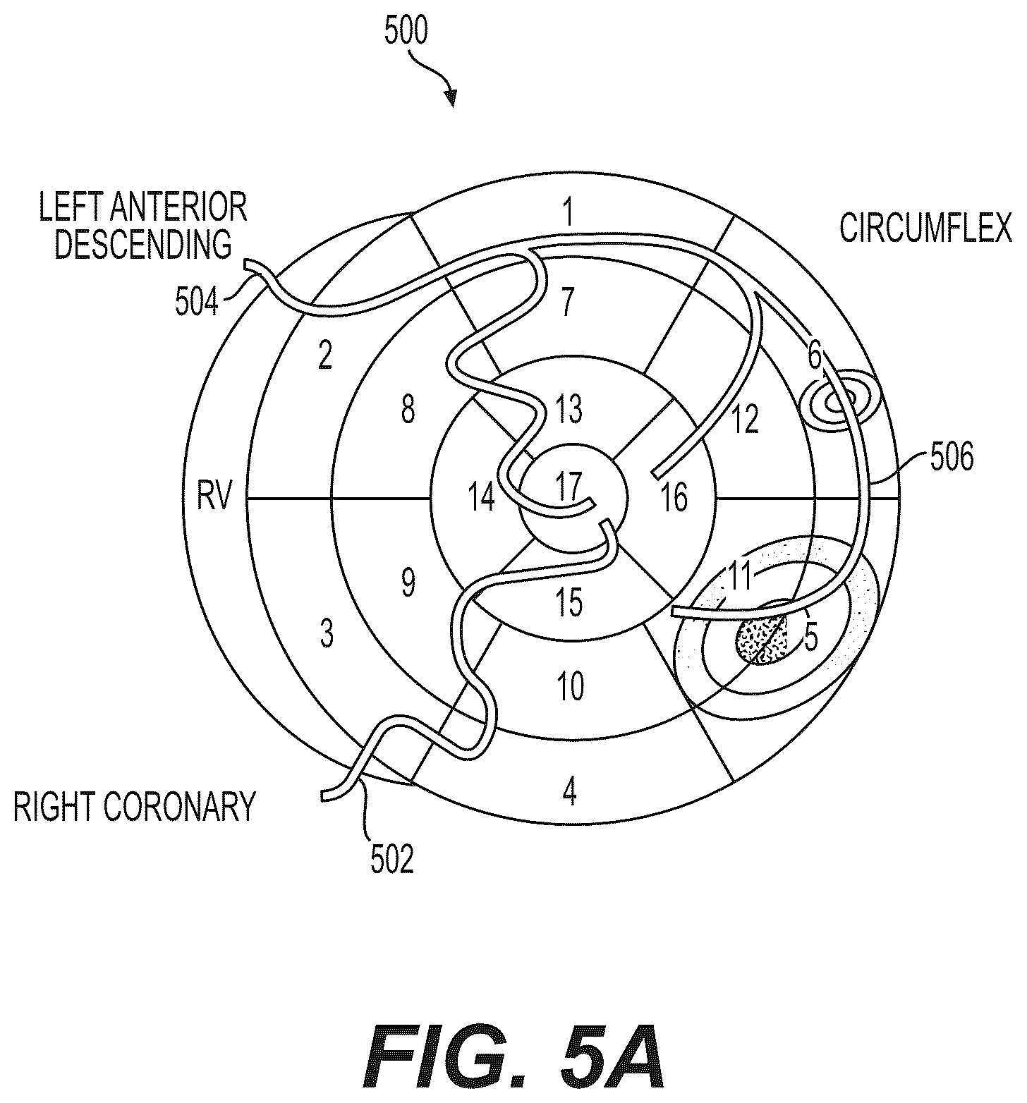 Patent US12551112 Figure 7 – Method and system for visualization of heart tissue at risk