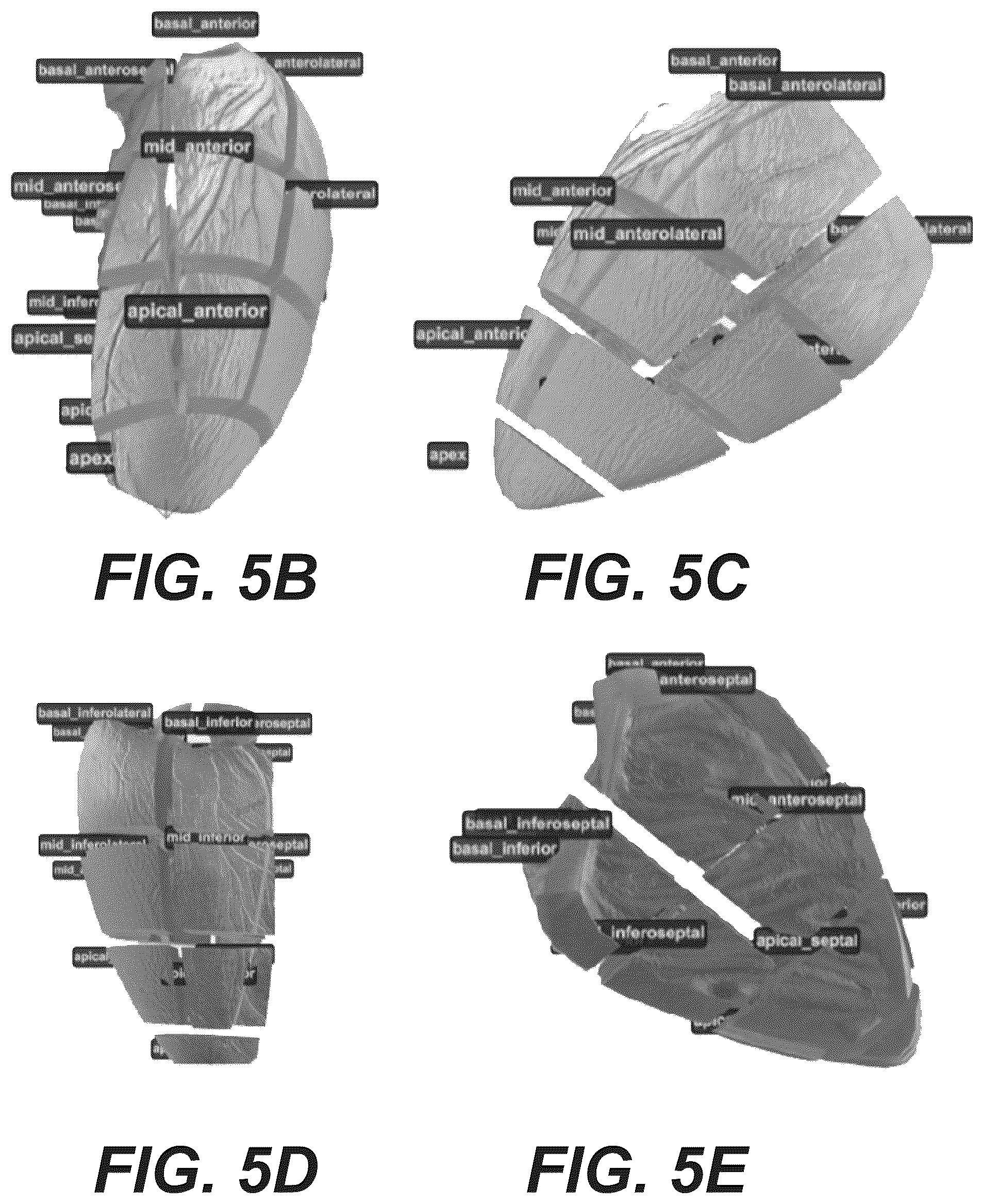 Patent US12551112 Figure 8 – Method and system for visualization of heart tissue at risk