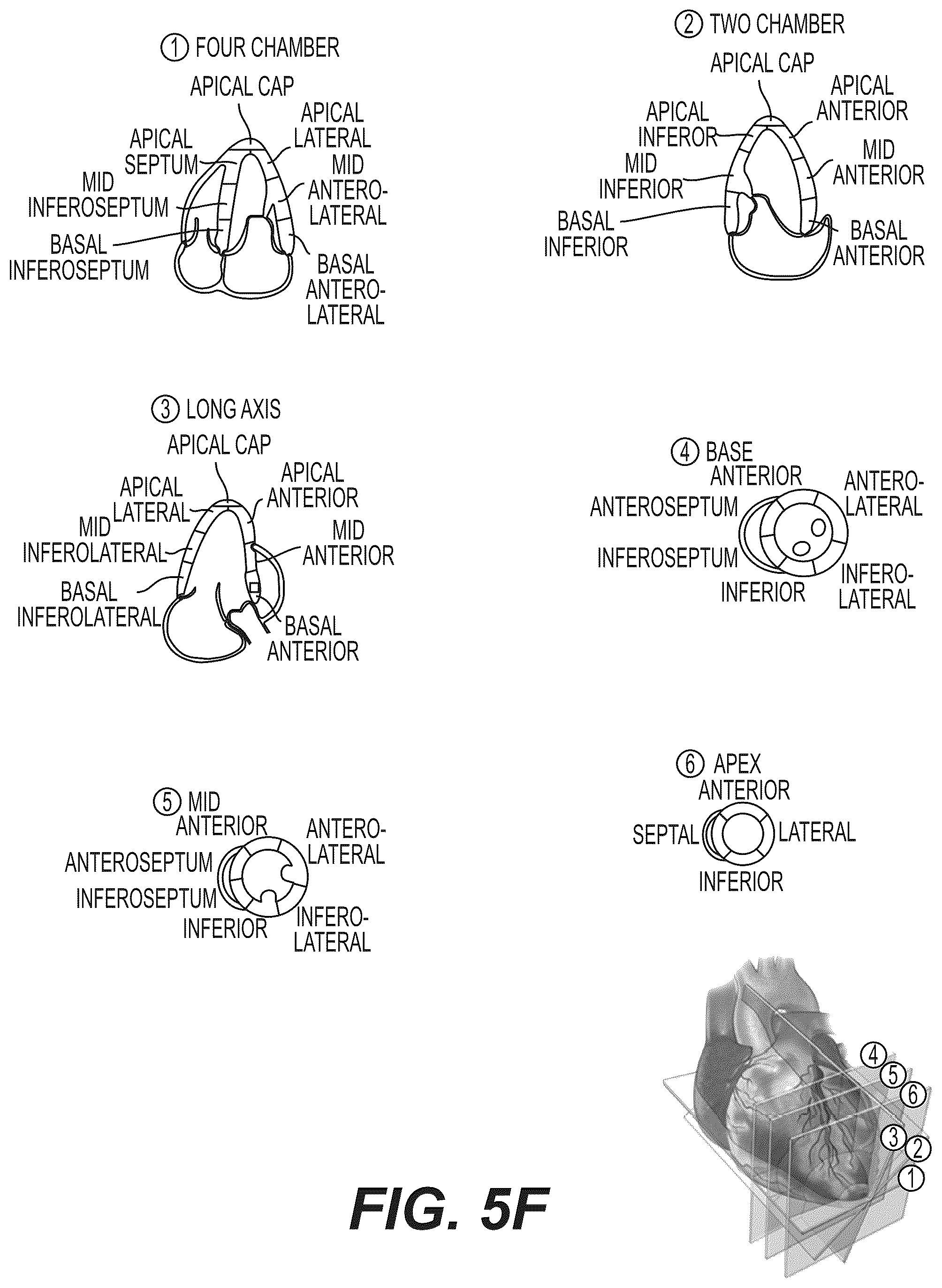 Patent US12551112 Figure 9 – Method and system for visualization of heart tissue at risk