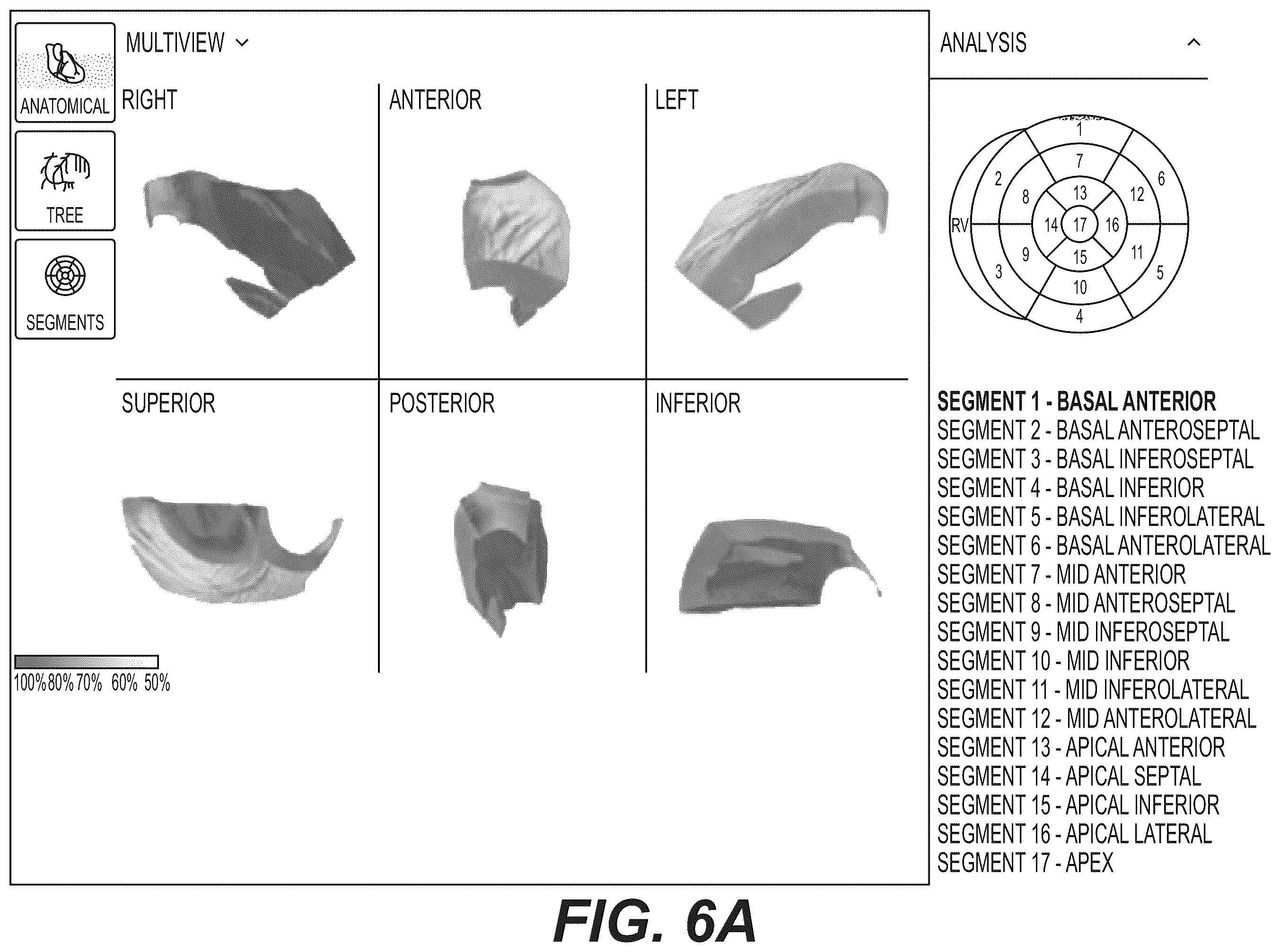 Patent US12551112 Figure 11 – Method and system for visualization of heart tissue at risk