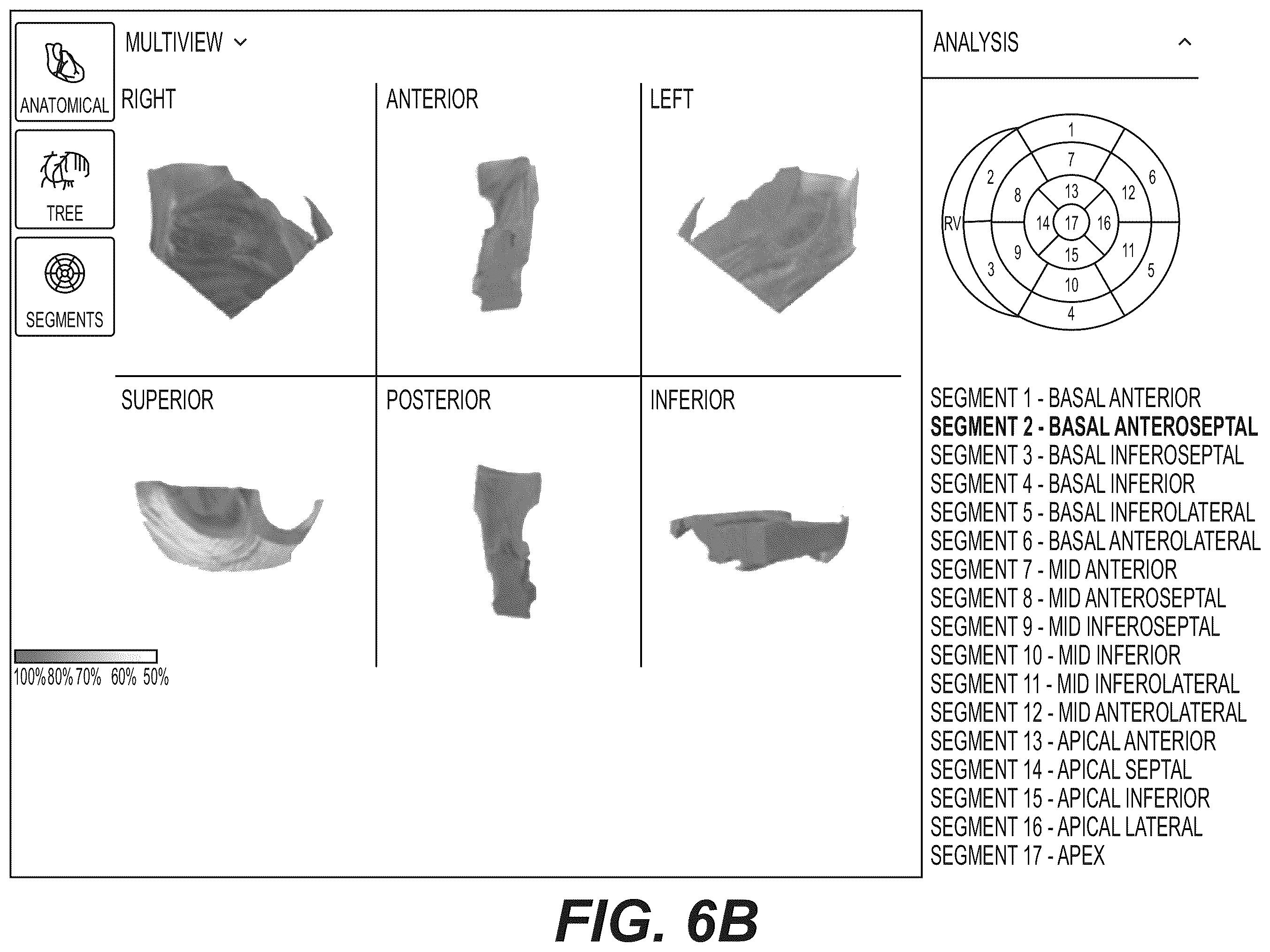 Patent US12551112 Figure 12 – Method and system for visualization of heart tissue at risk