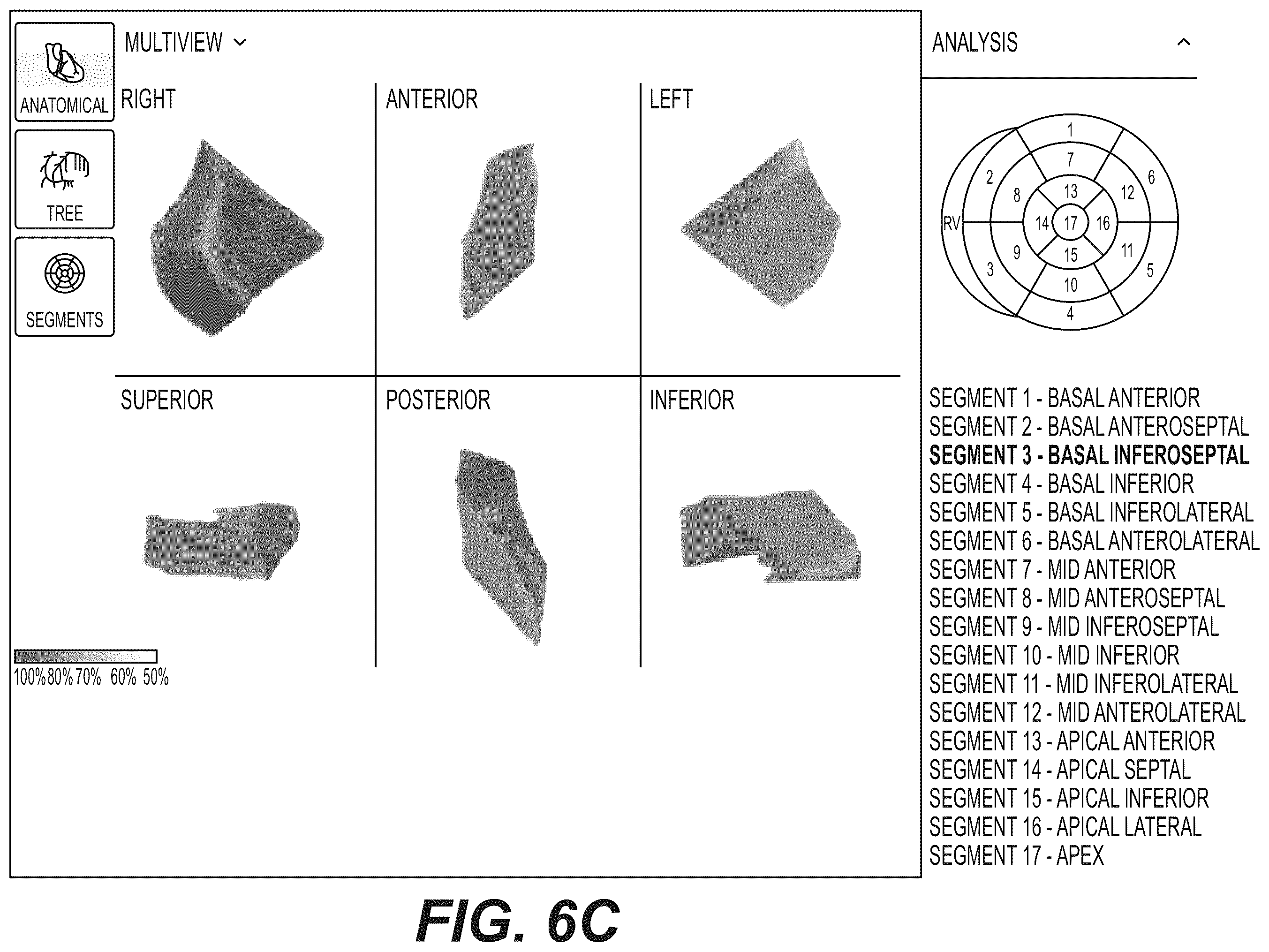 Patent US12551112 Figure 13 – Method and system for visualization of heart tissue at risk