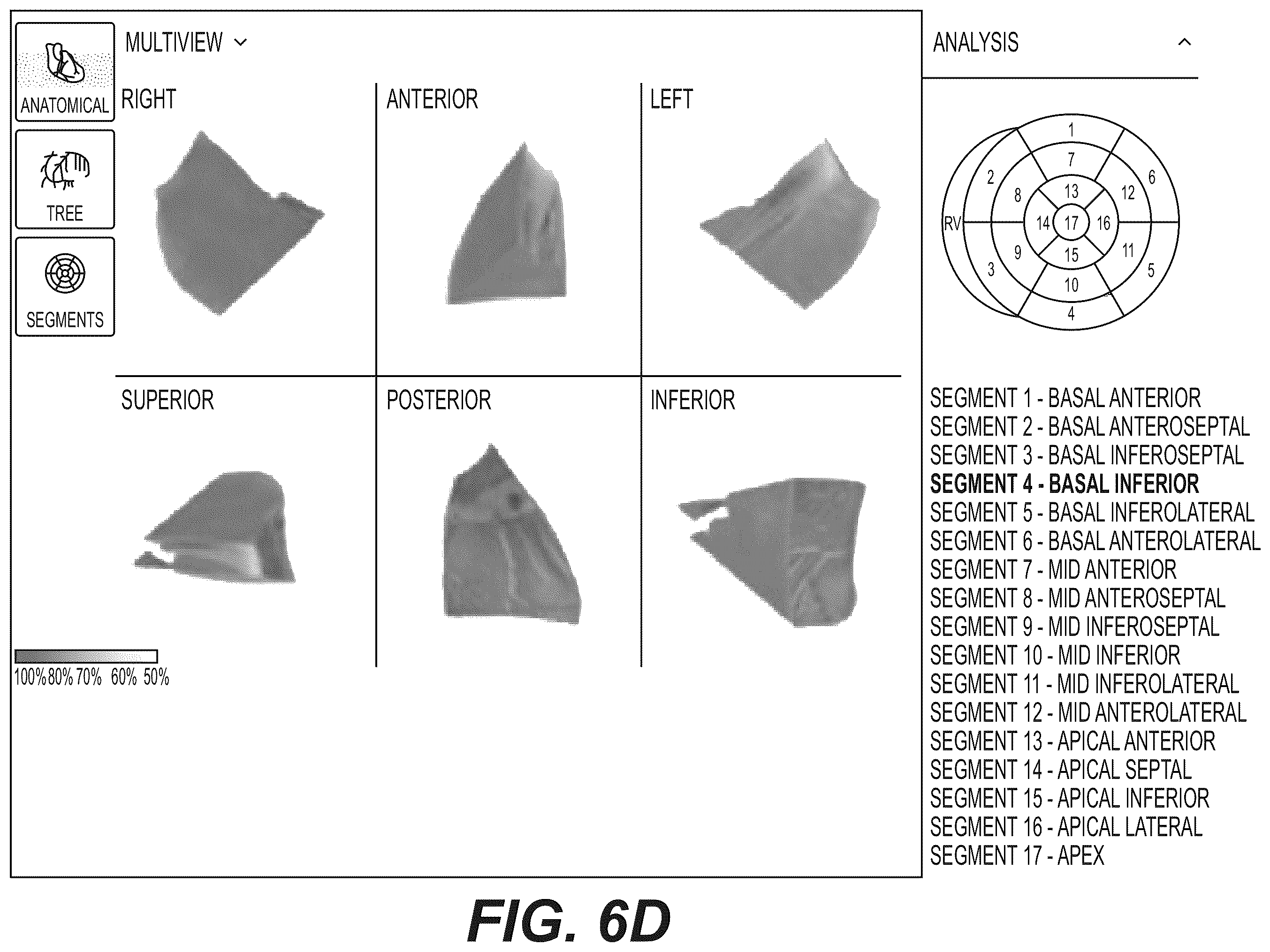 Patent US12551112 Figure 14 – Method and system for visualization of heart tissue at risk