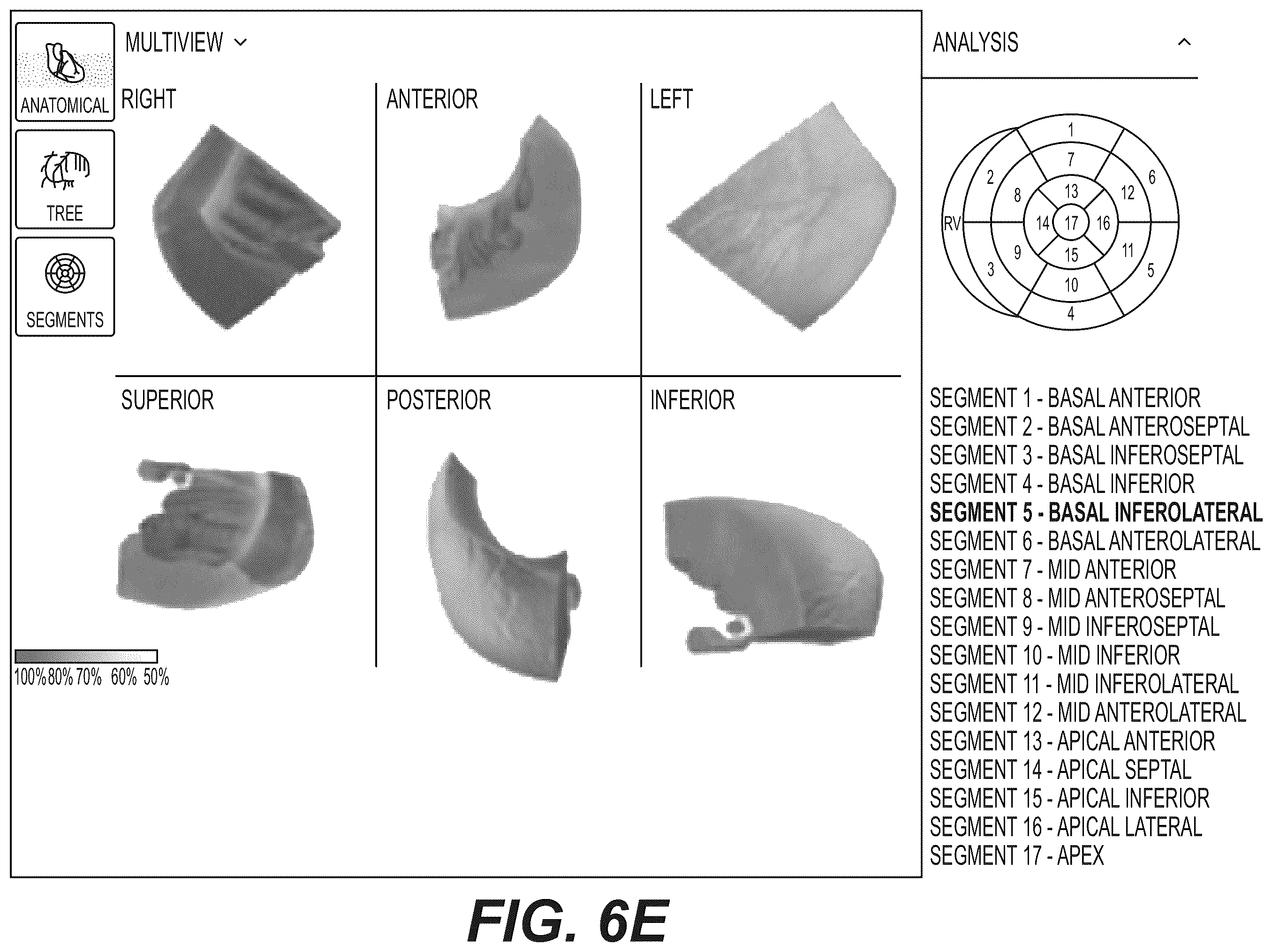 Patent US12551112 Figure 15 – Method and system for visualization of heart tissue at risk