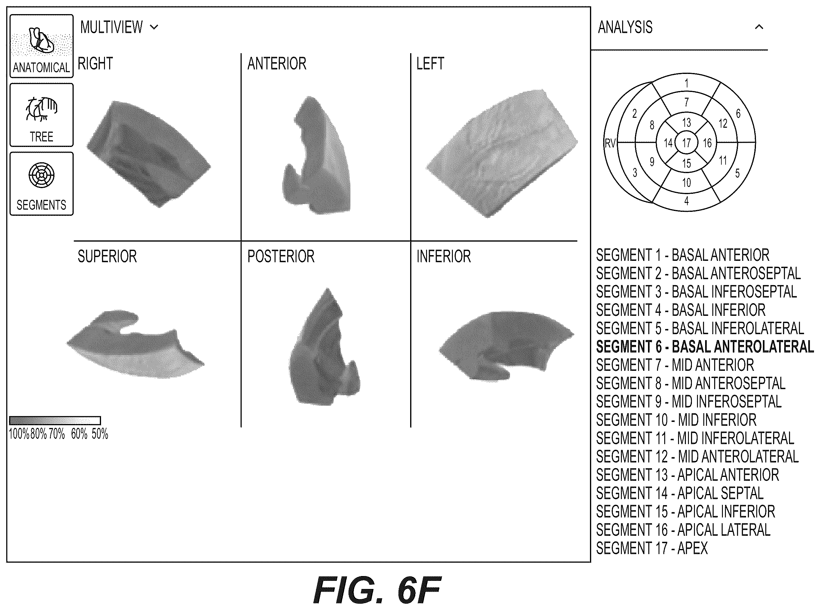 Patent US12551112 Figure 16 – Method and system for visualization of heart tissue at risk
