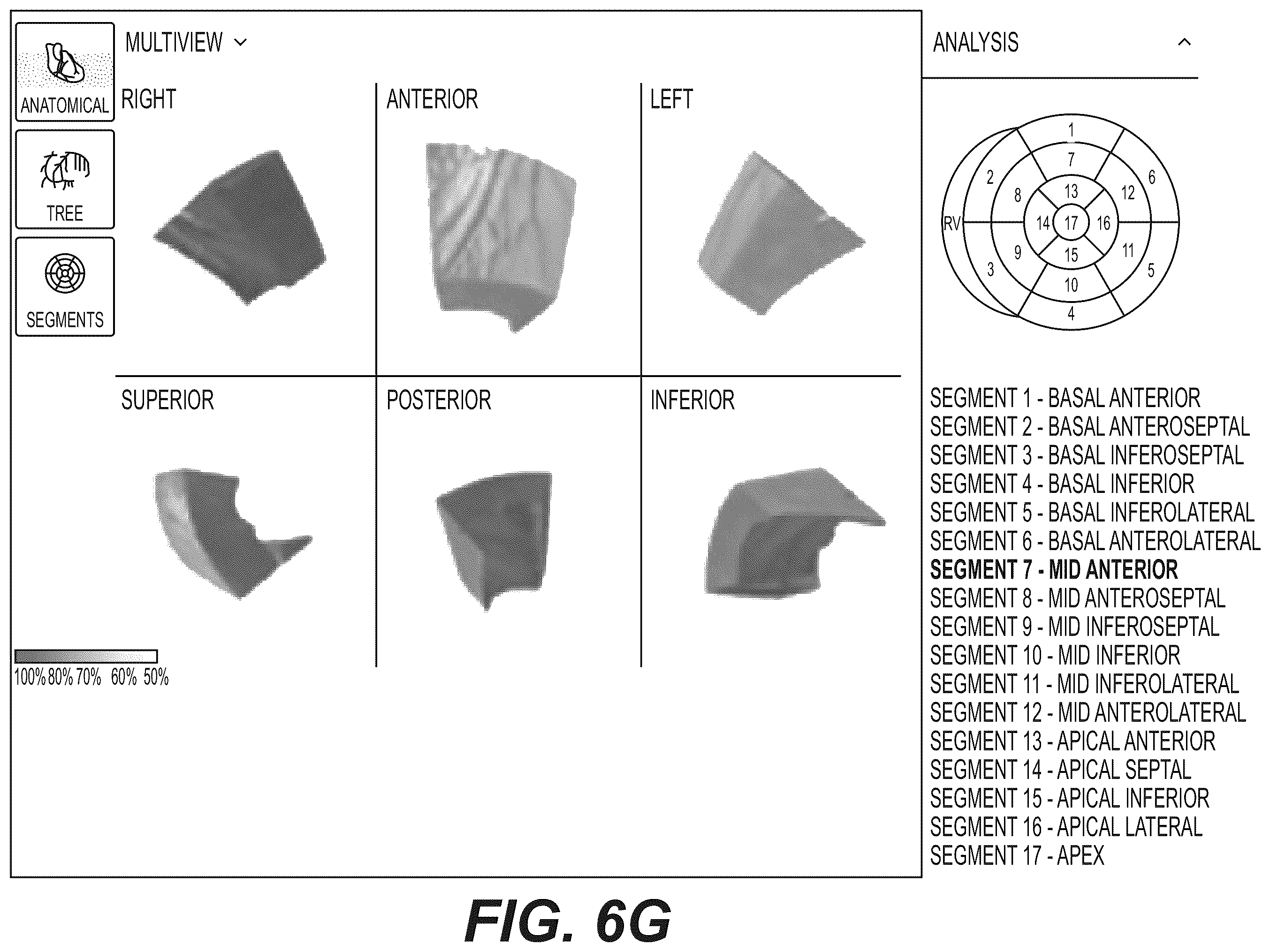 Patent US12551112 Figure 17 – Method and system for visualization of heart tissue at risk