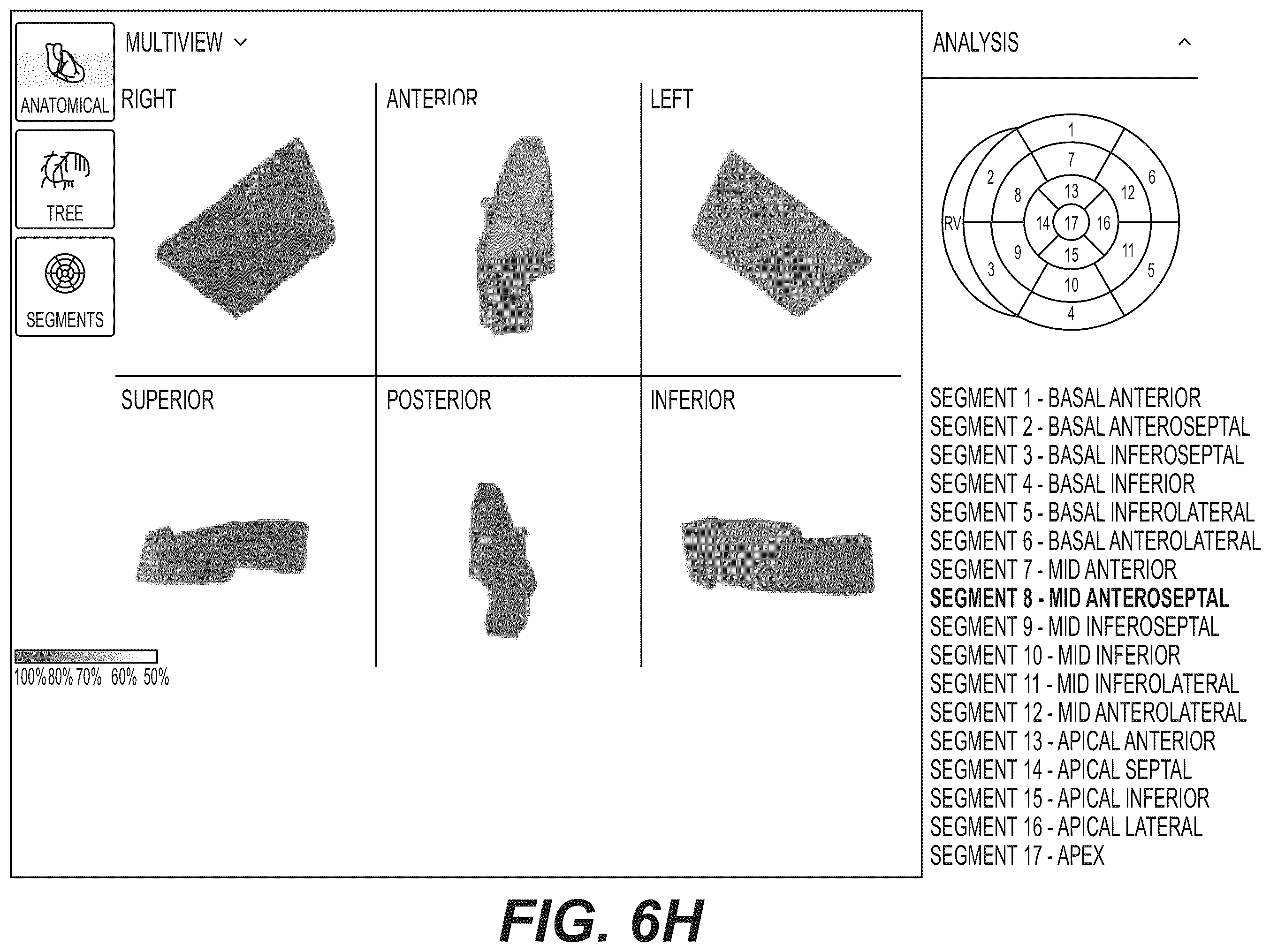 Patent US12551112 Figure 18 – Method and system for visualization of heart tissue at risk