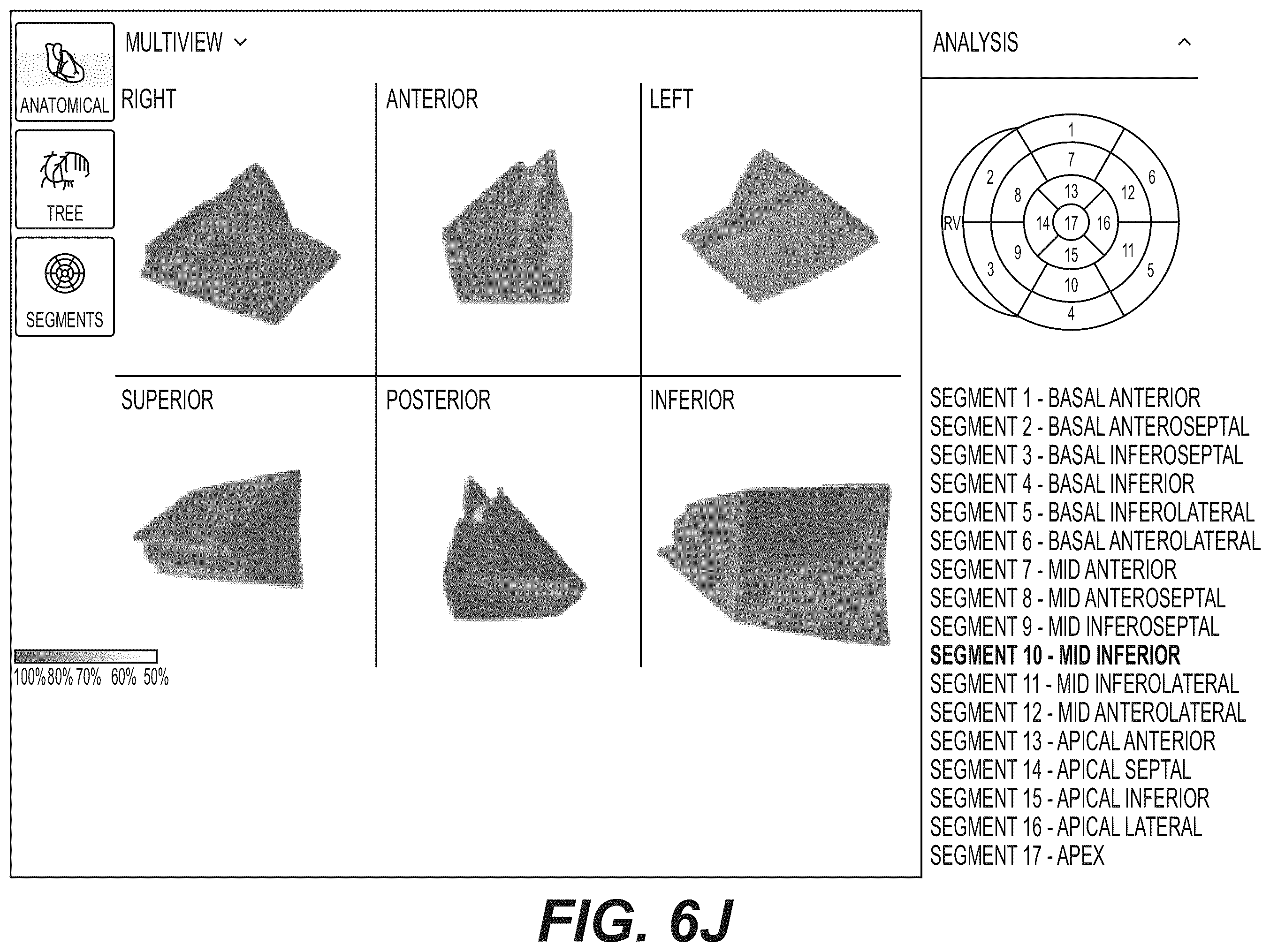 Patent US12551112 Figure 20 – Method and system for visualization of heart tissue at risk