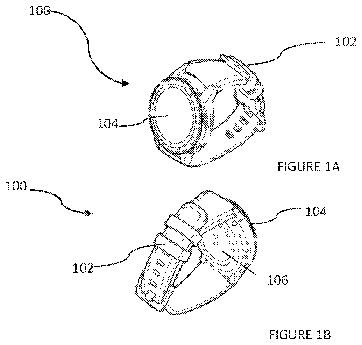 Patent US12551114 Figure 1 – System for detecting abnormal blood volume and pressure