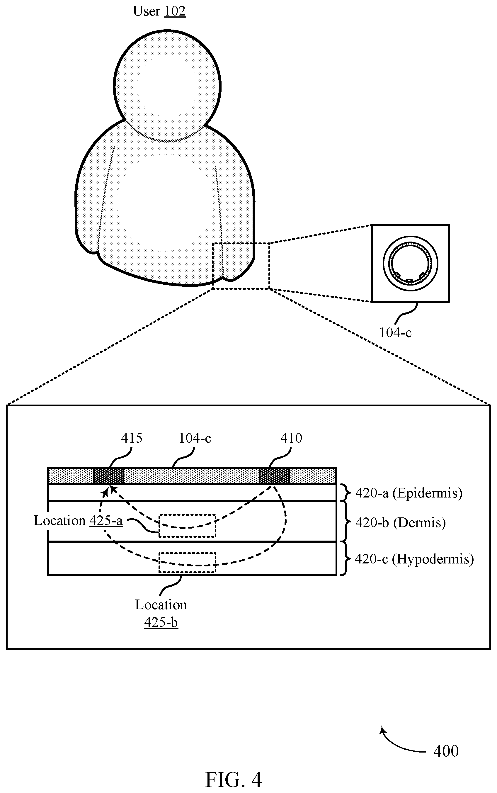 Patent US12551116 Figure 4 – Techniques for determining blood pressure based on a relative timing of pulses