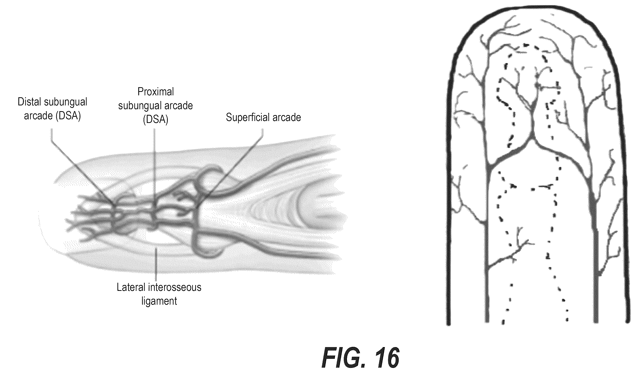 Patent US12551124 Figure 18 – Systems and methods for measuring capillary refill time