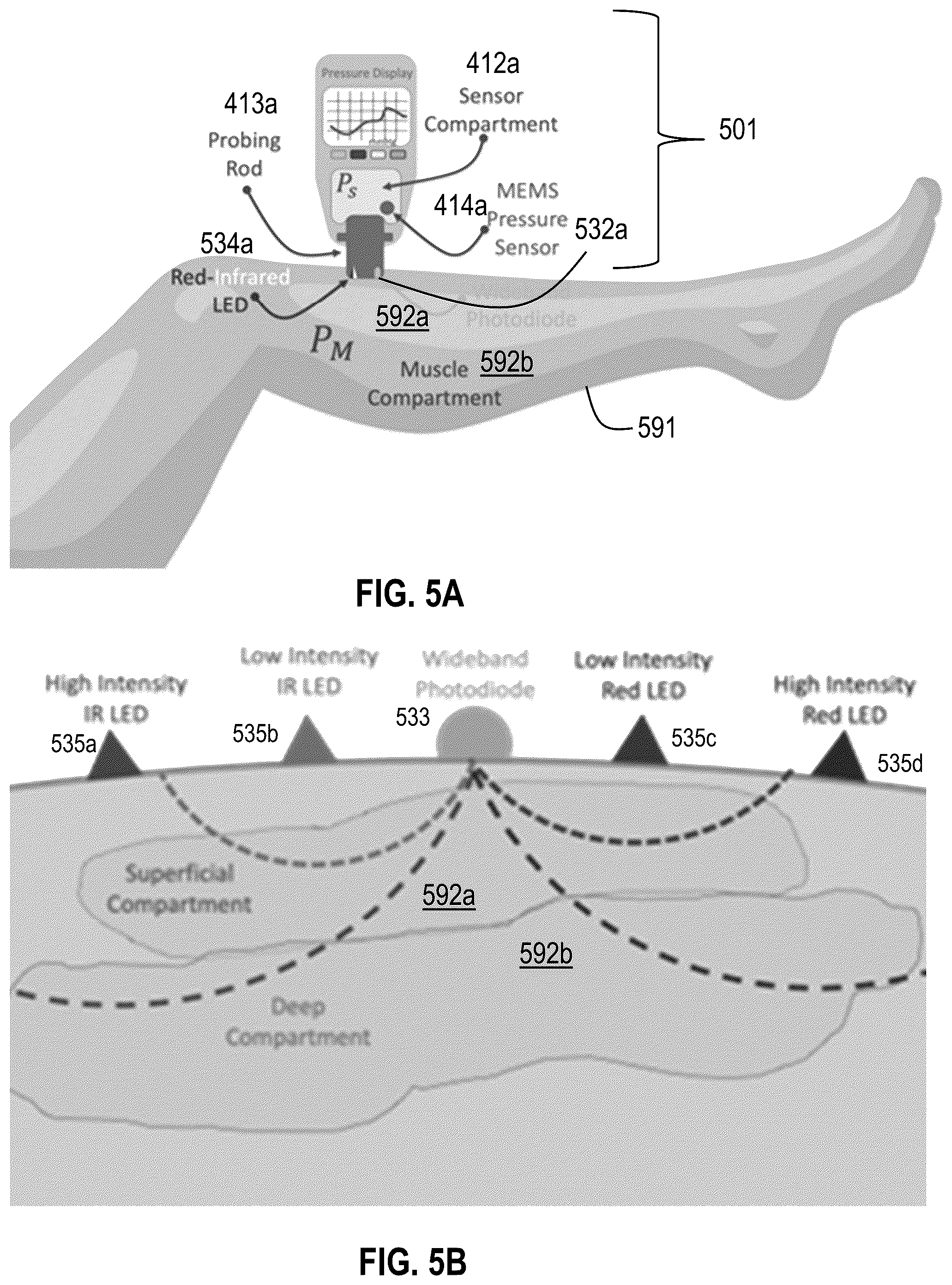 Patent US12551125 Figure 12 – Handheld non-invasive compartment syndrome detector