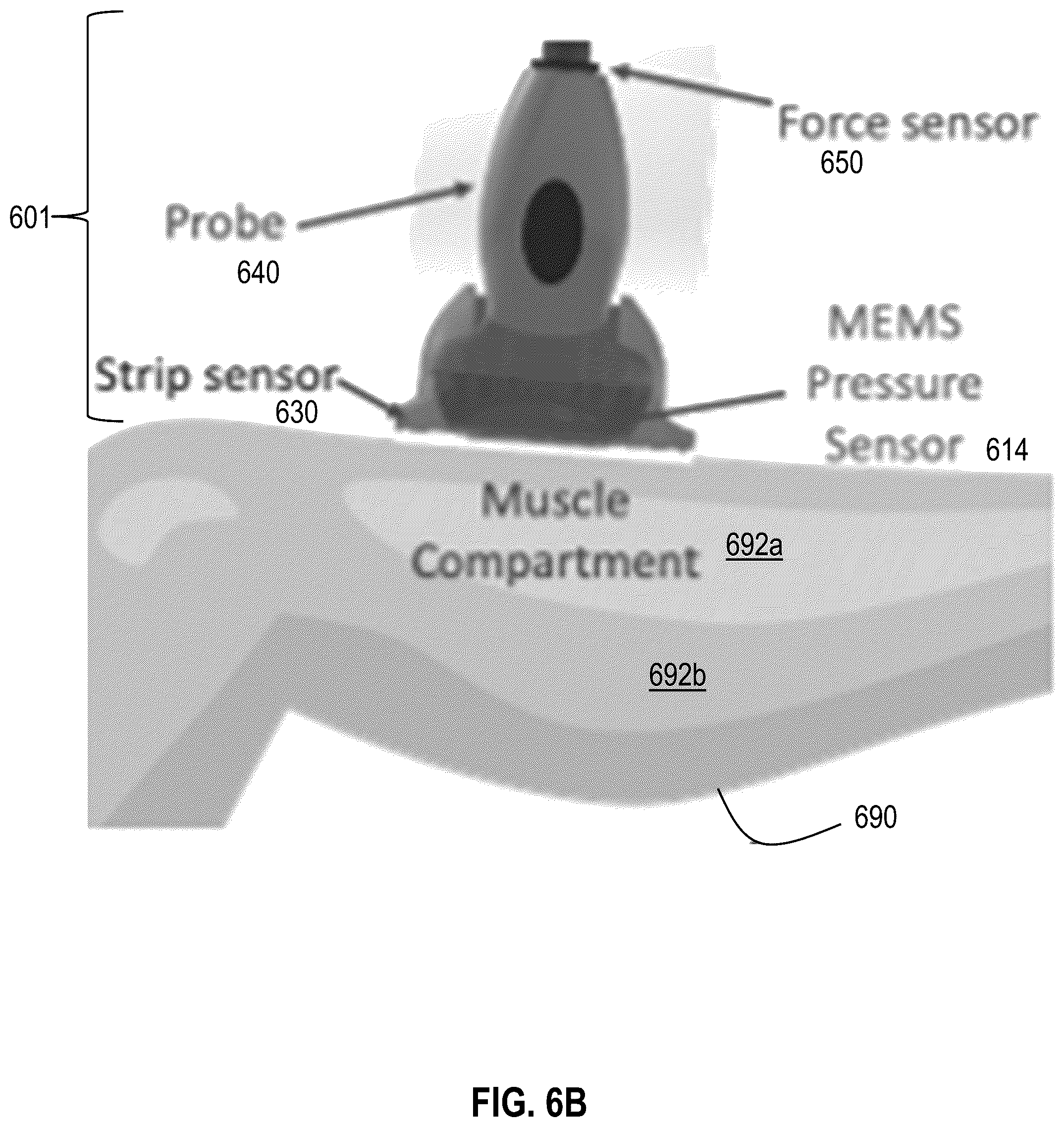 Patent US12551125 Figure 16 – Handheld non-invasive compartment syndrome detector