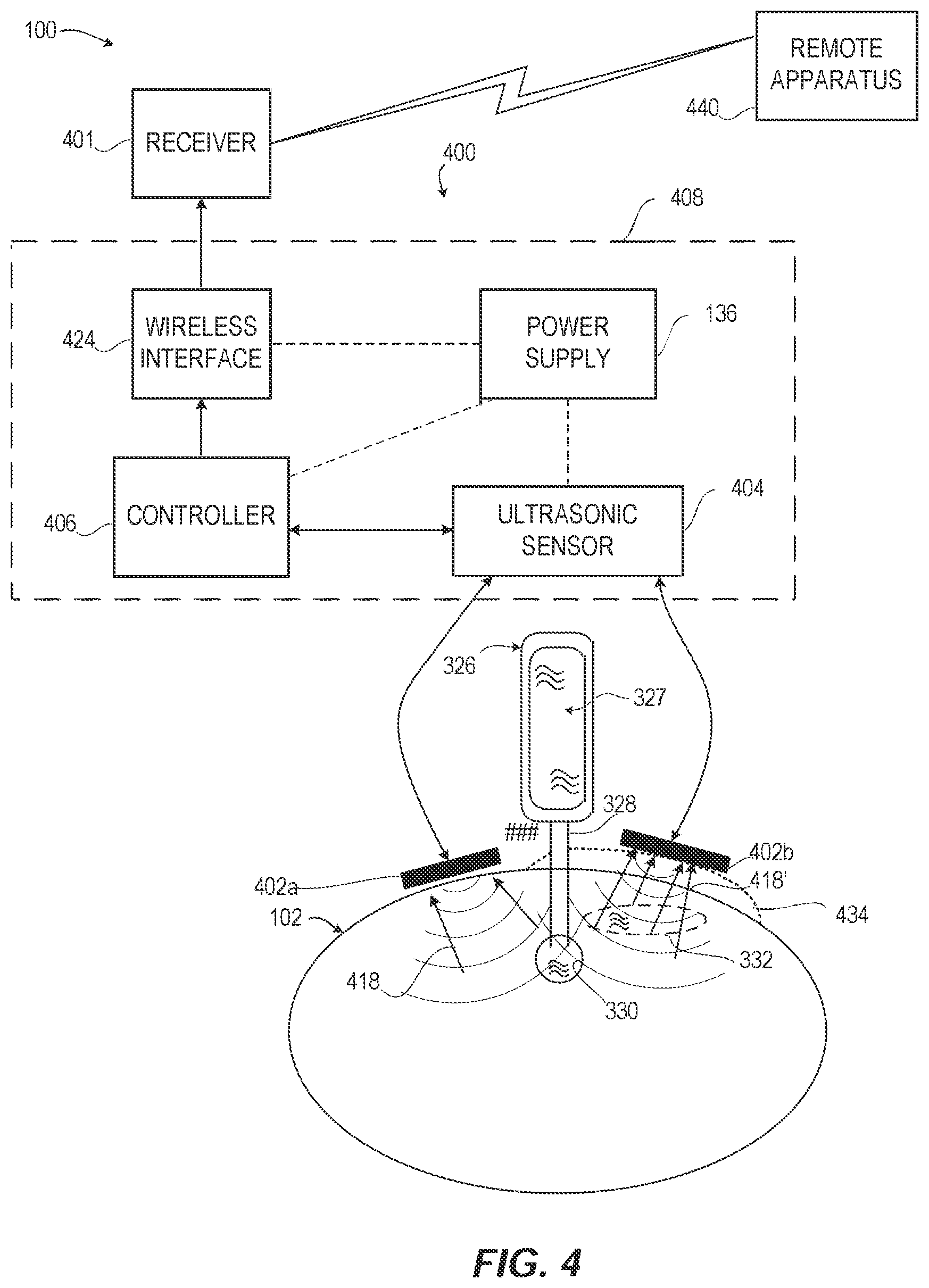 Patent US12551126 Figure 4 – Distributed extravasation detection system for fluid change and to control the fluids levels in a body via wireless interface based on rate of activation