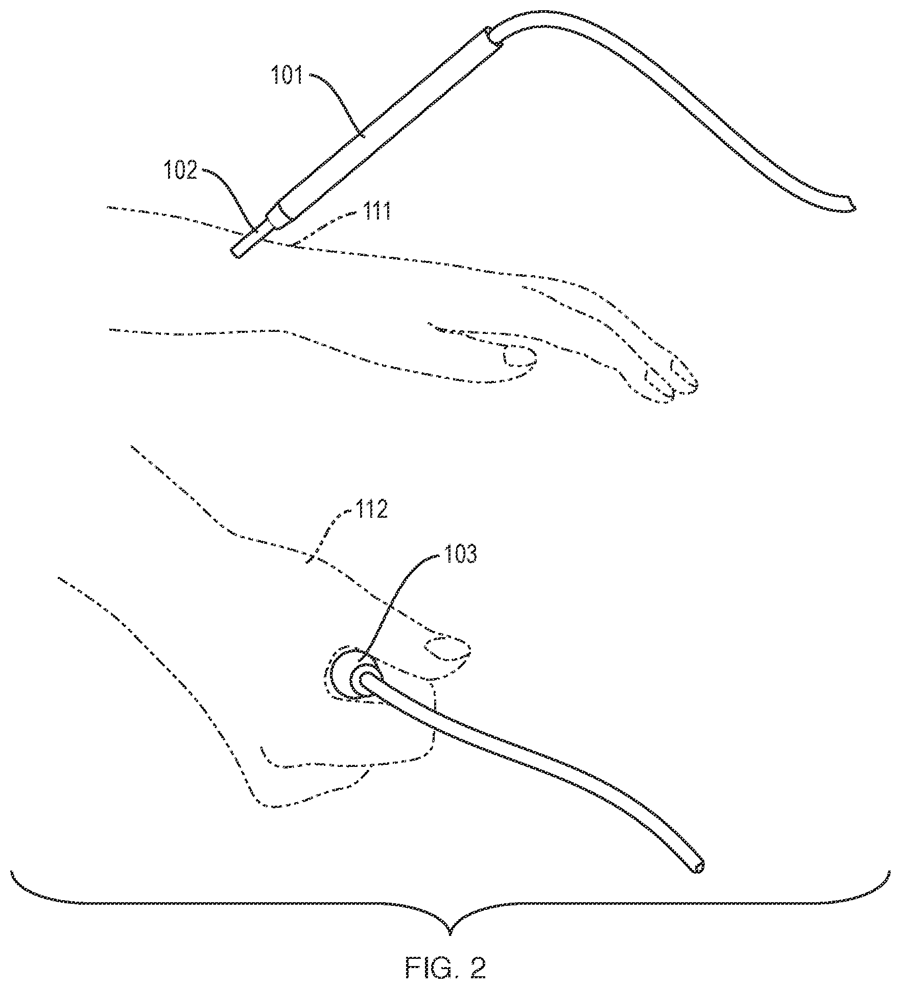 Patent US12551128 Figure 2 – Methods and apparatus for electro-meridian diagnostics