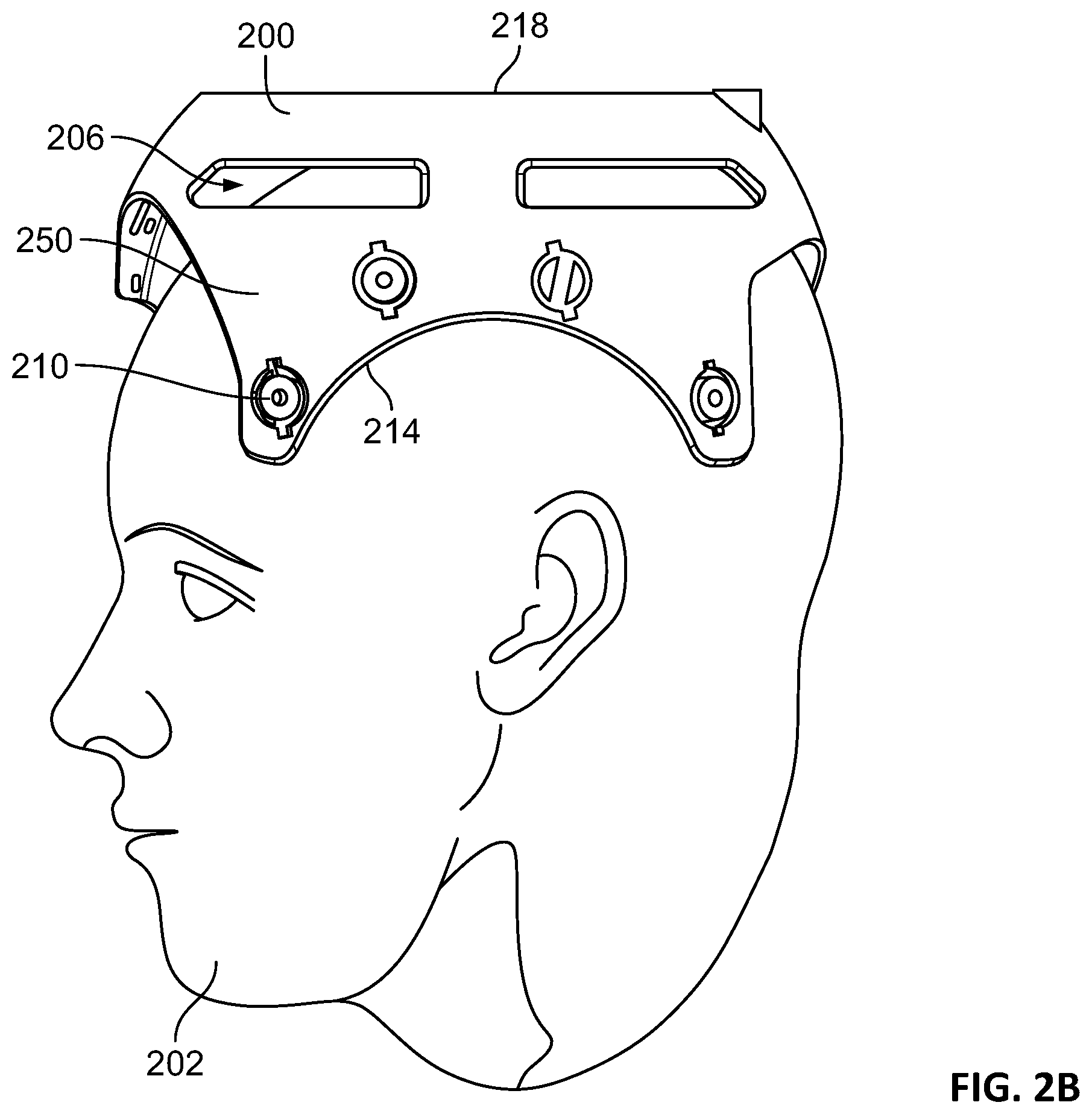 Patent US12551129 Figure 3 – Skull-contoured MRI localizer